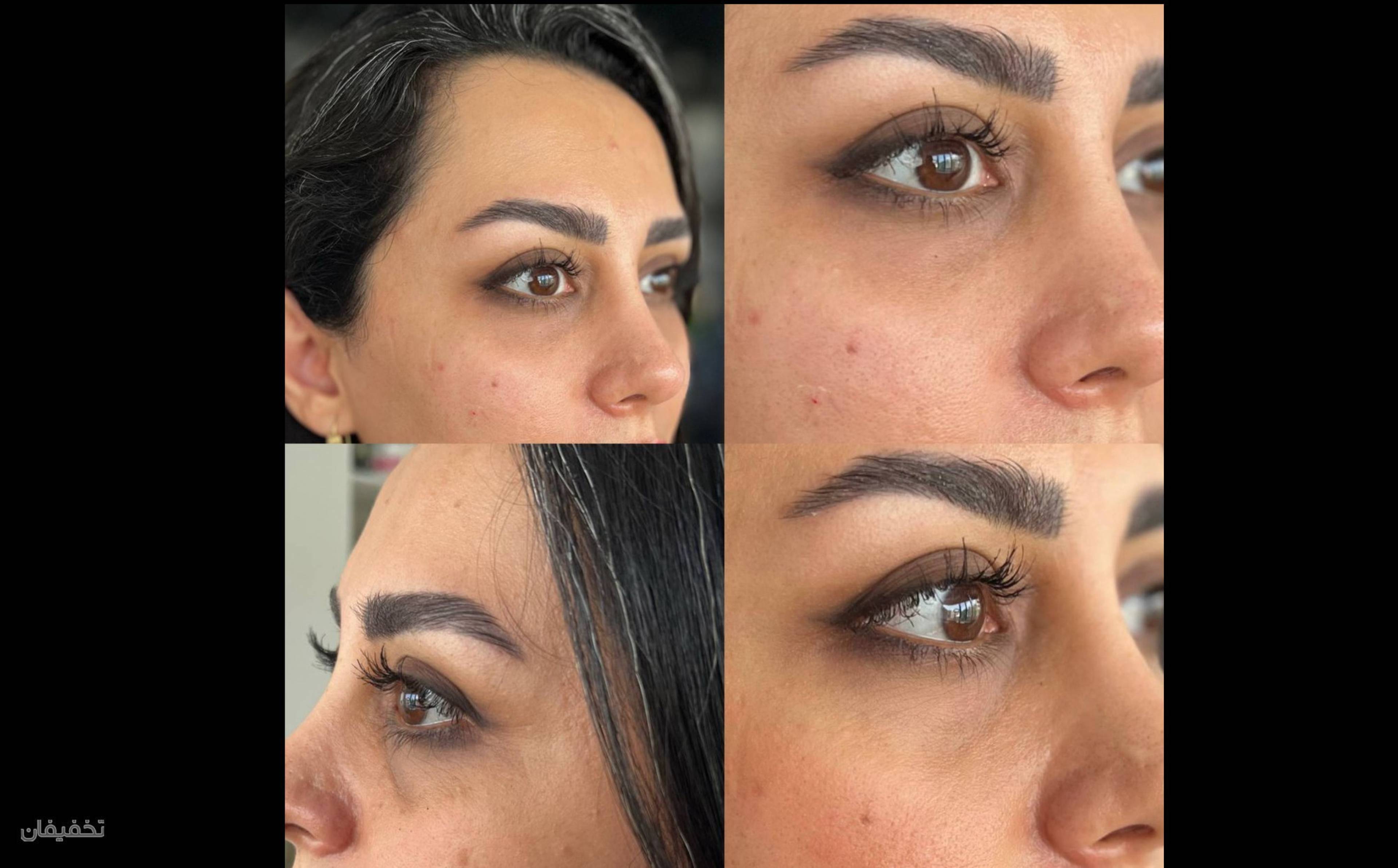کلینیک پوست مو لیزر لاغری زیباریس