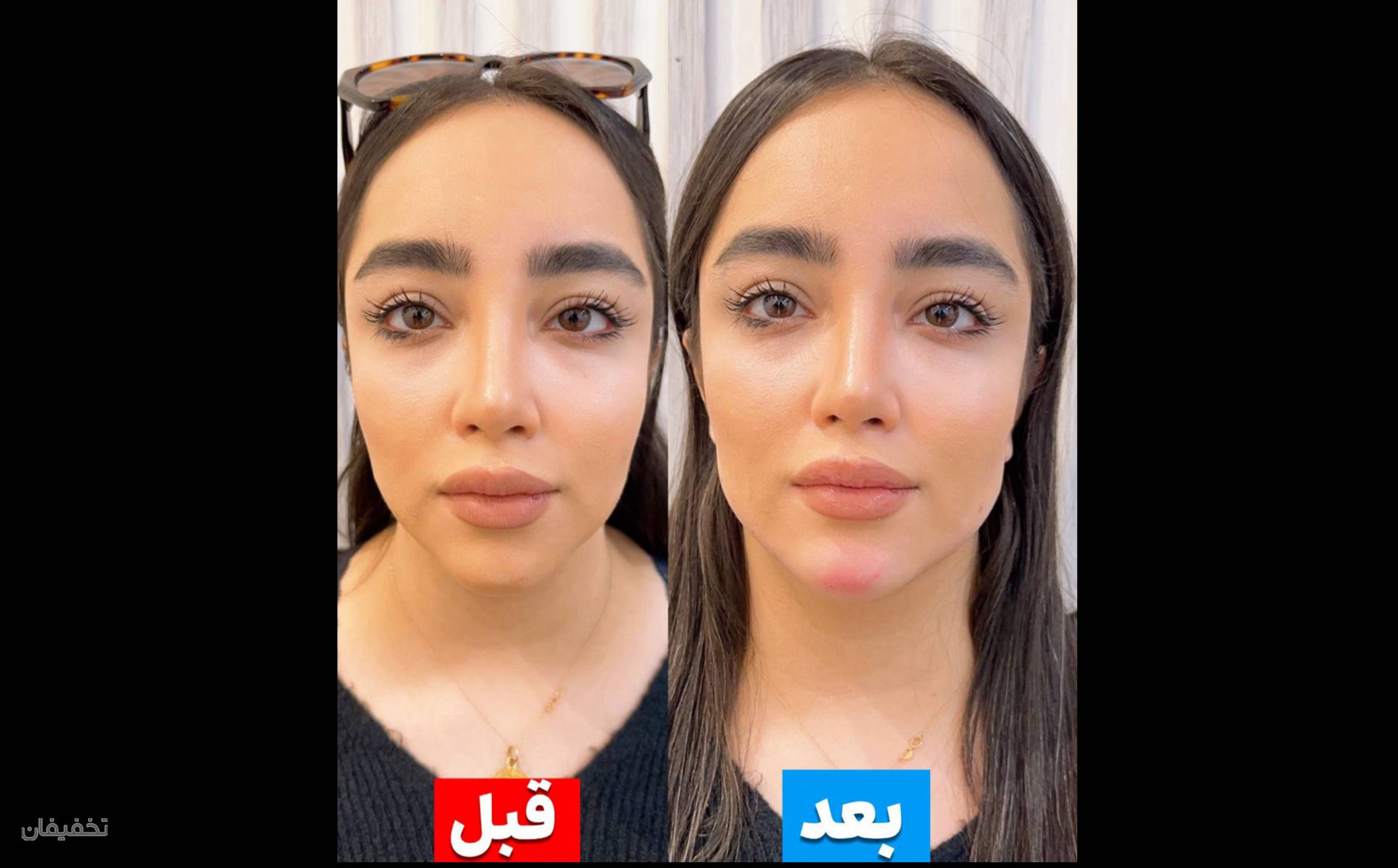 کلینیک پوست مو لیزر لاغری زیباریس