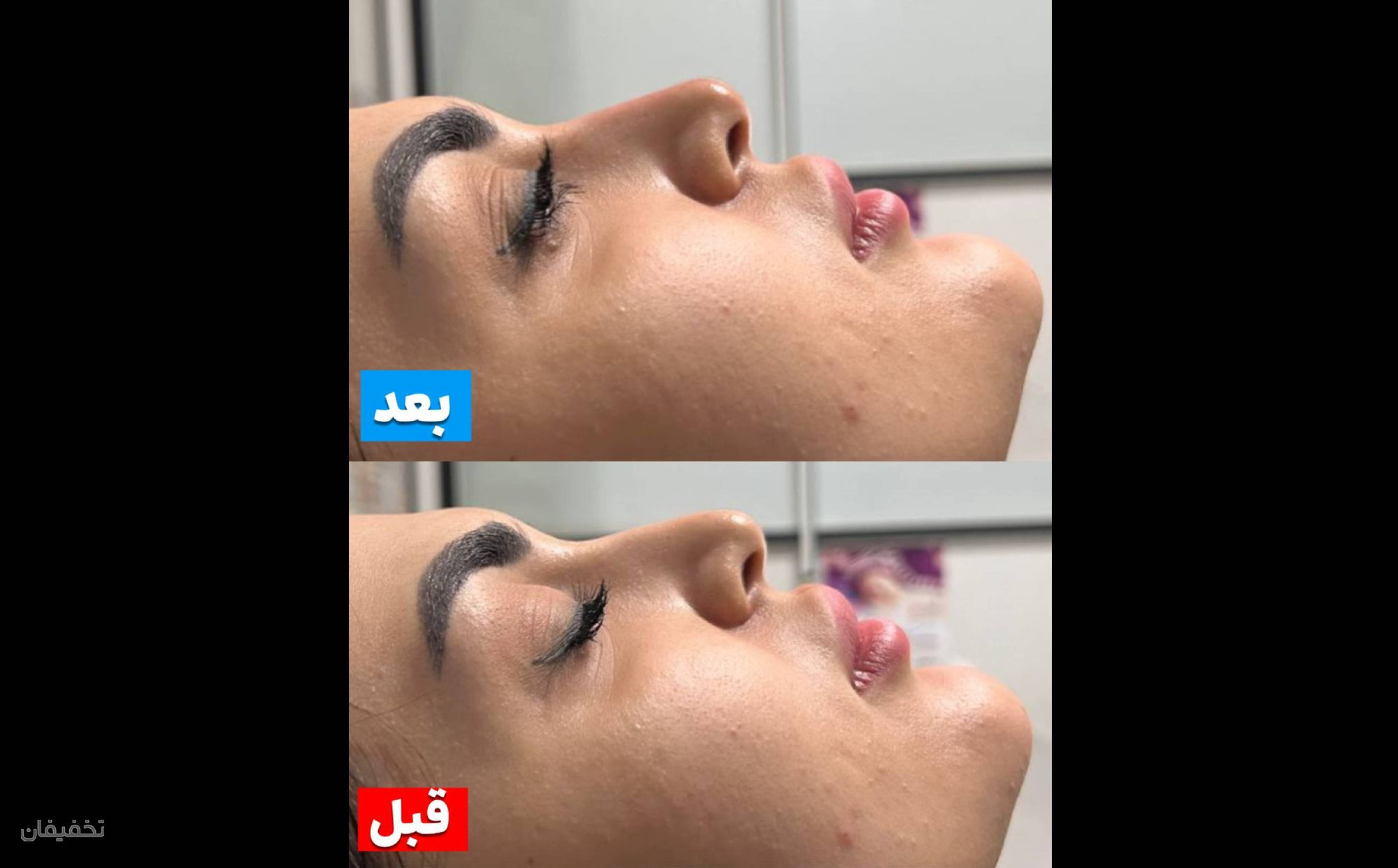 کلینیک پوست مو لیزر لاغری زیباریس