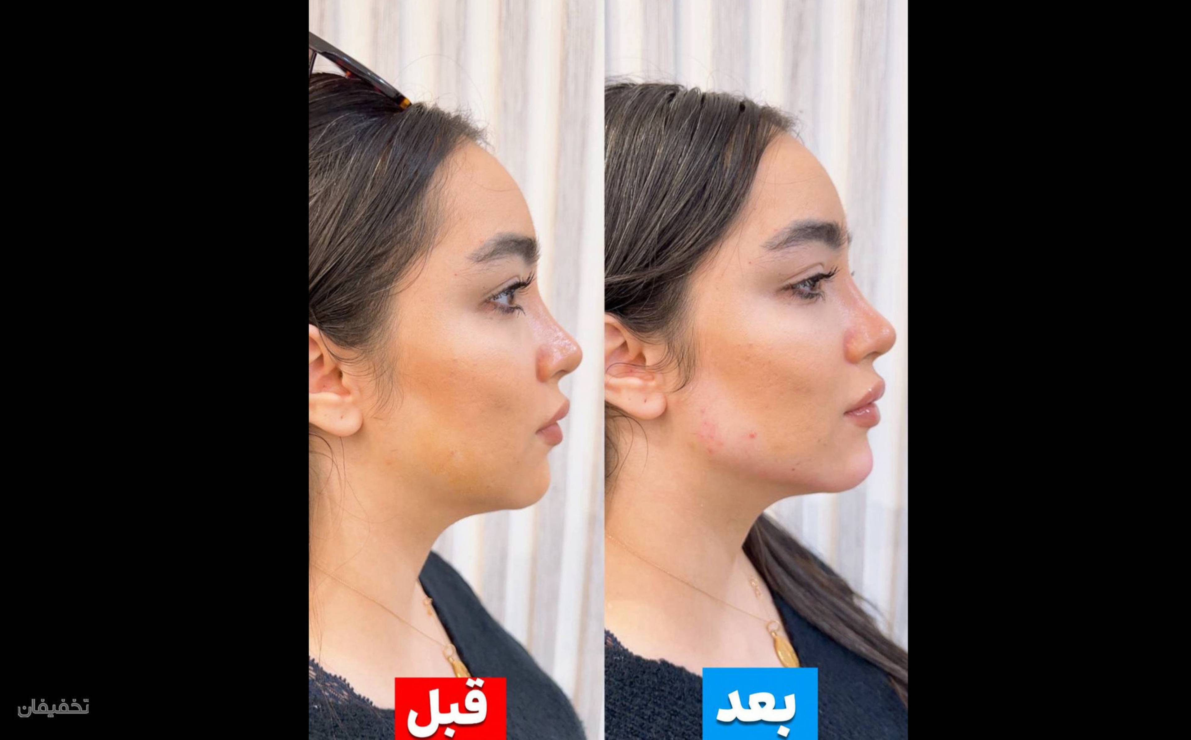 کلینیک پوست مو لیزر لاغری زیباریس