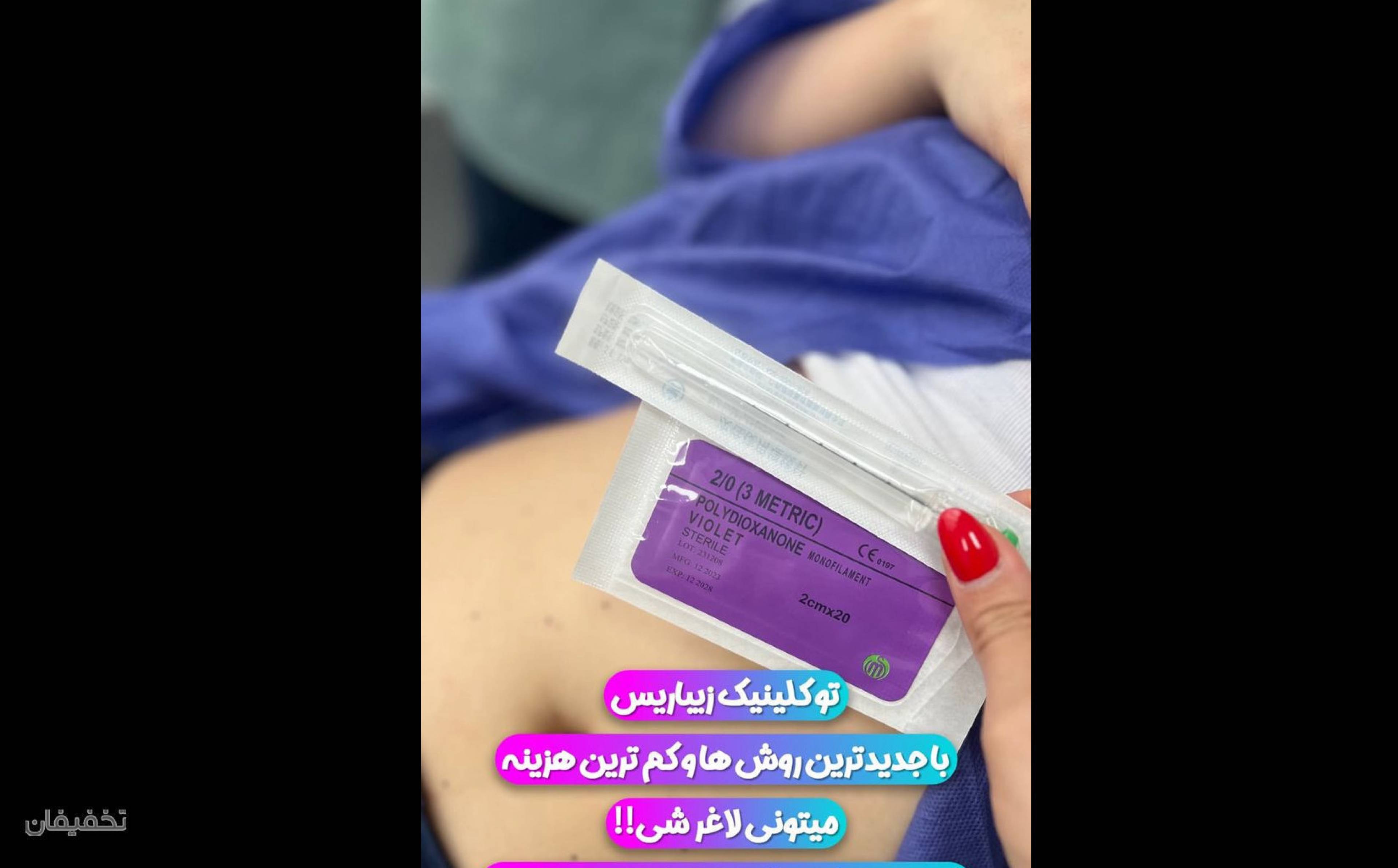 کلینیک پوست مو لیزر لاغری زیباریس