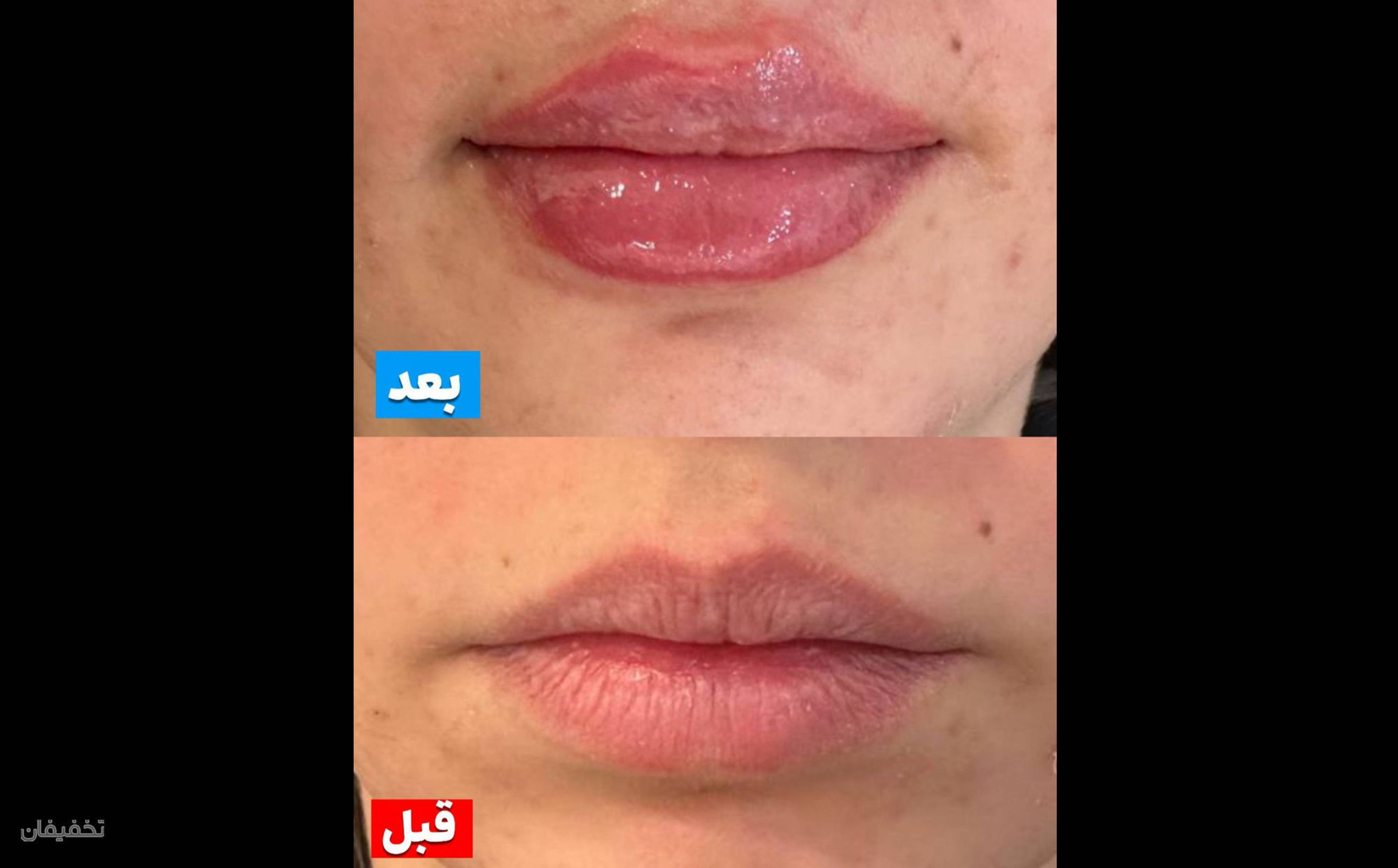 کلینیک پوست مو لیزر لاغری زیباریس