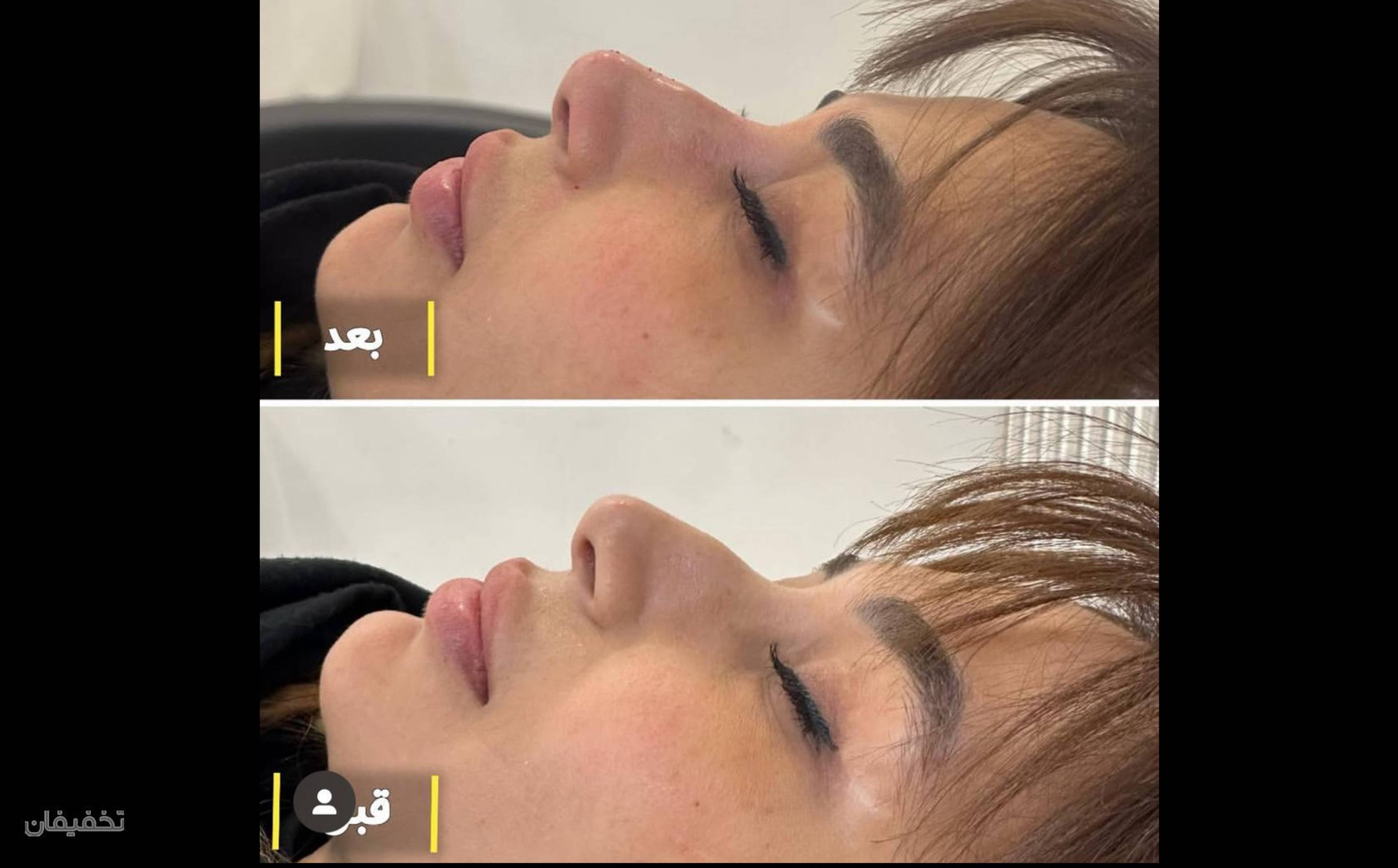 کلینیک پوست مو لیزر لاغری زیباریس