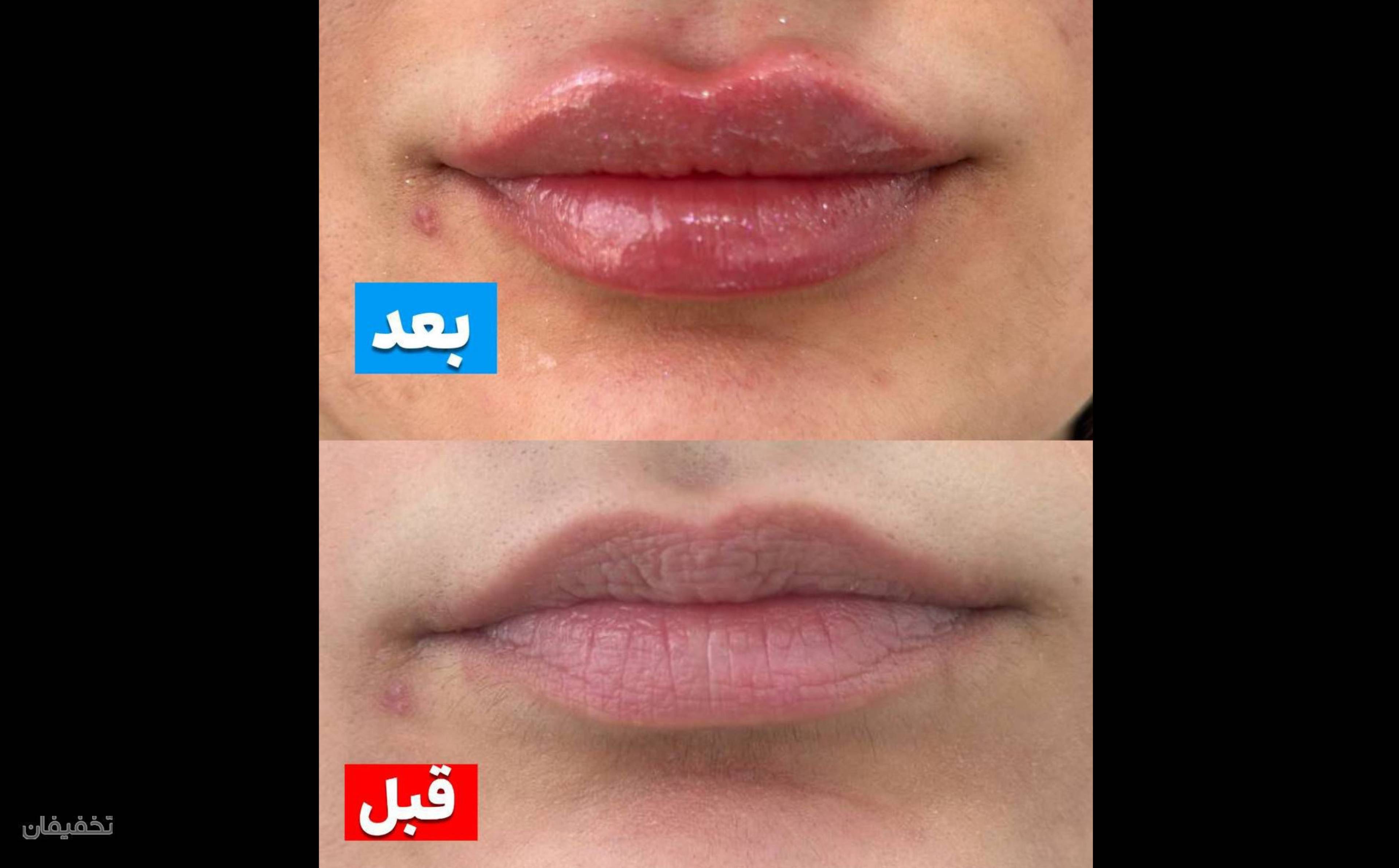 کلینیک پوست مو لیزر لاغری زیباریس
