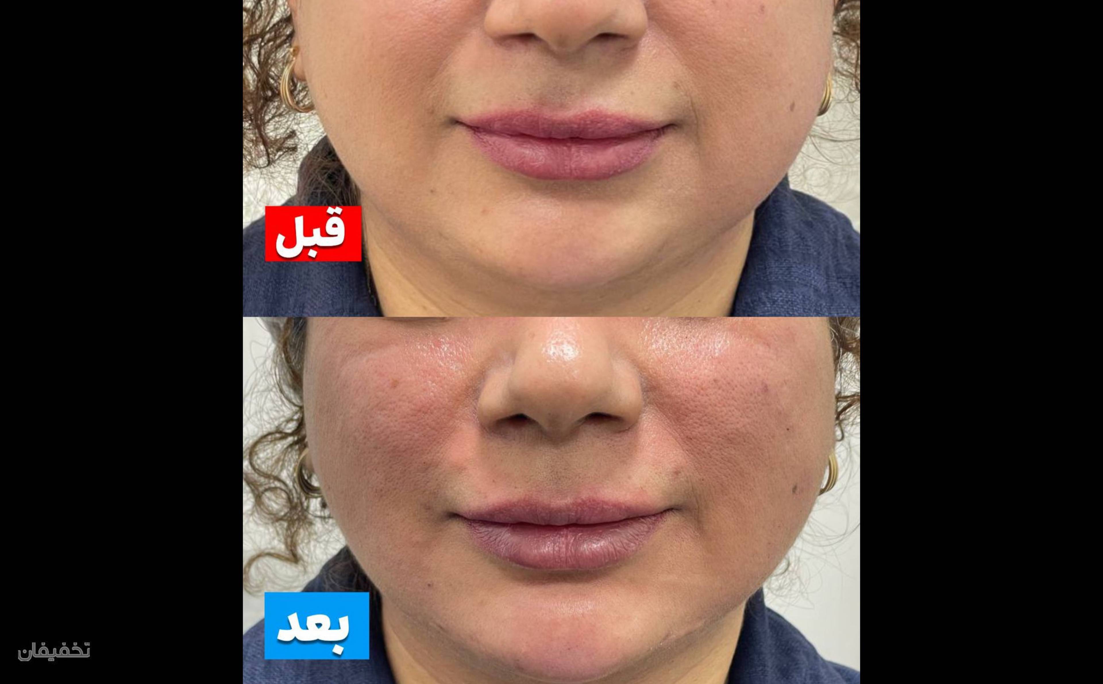 کلینیک پوست مو لیزر لاغری زیباریس