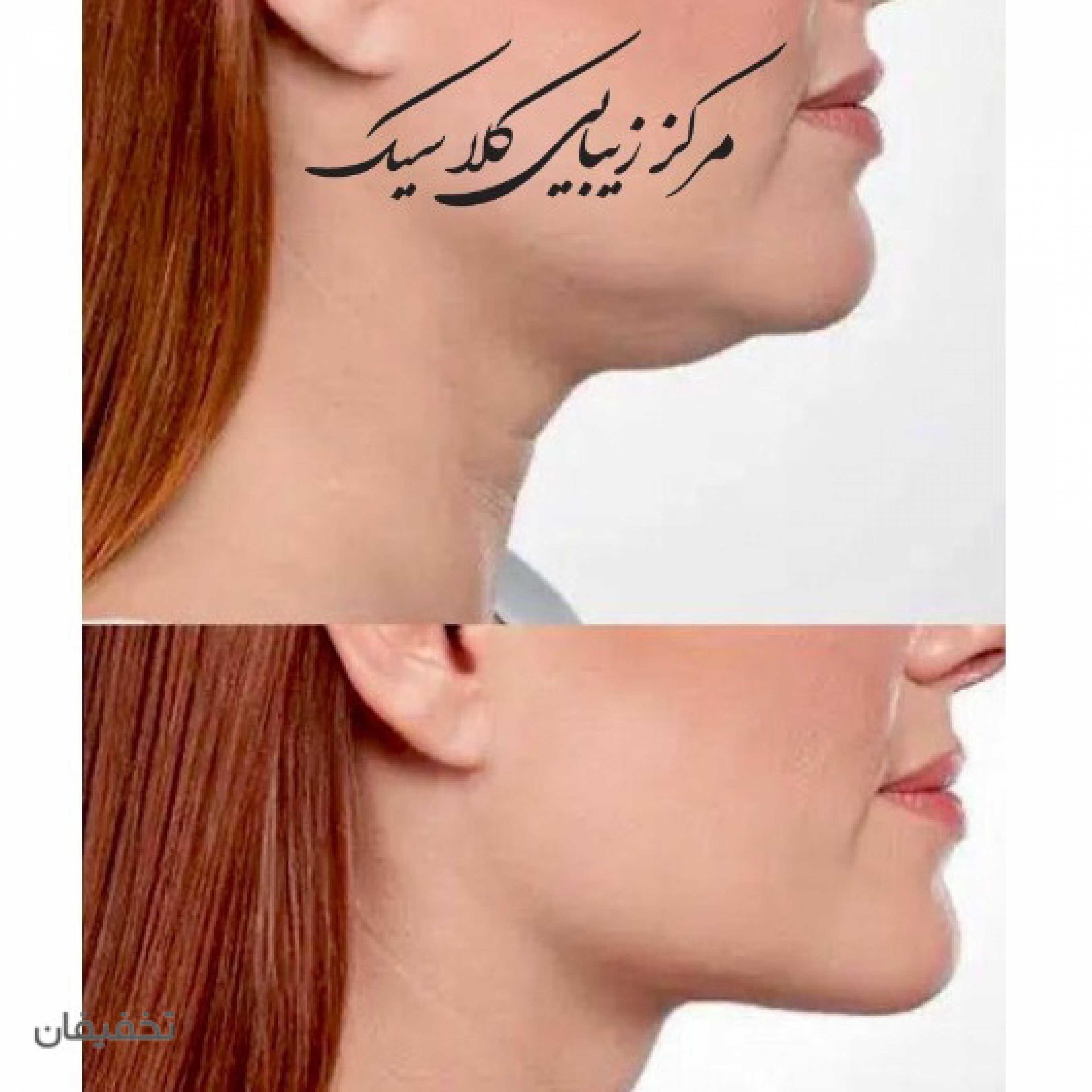 مرکز زیبایی کلاسیک