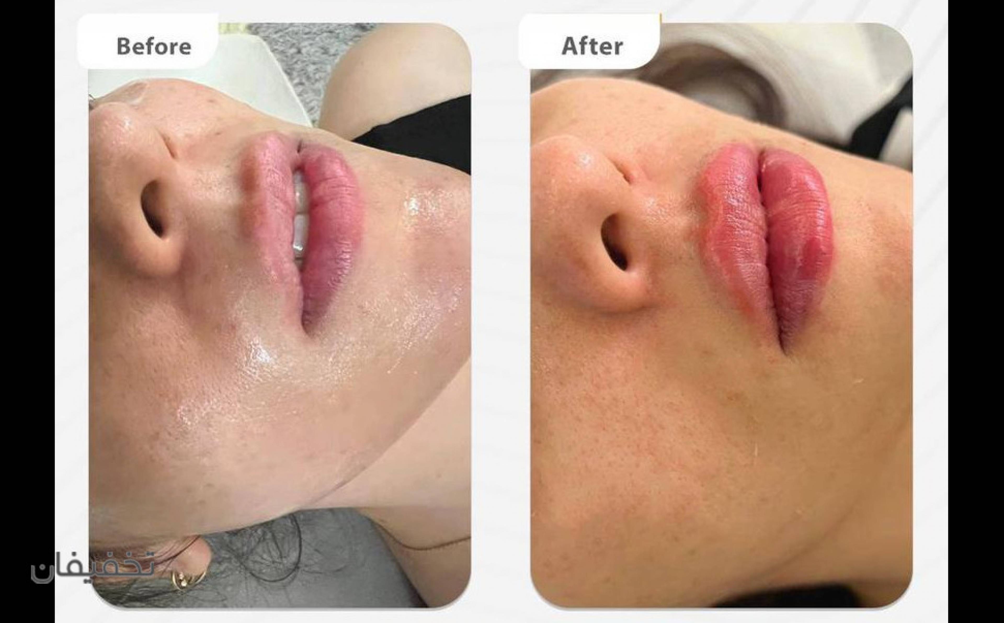 مطب زیبایی دکتر شاپور آیرملو
