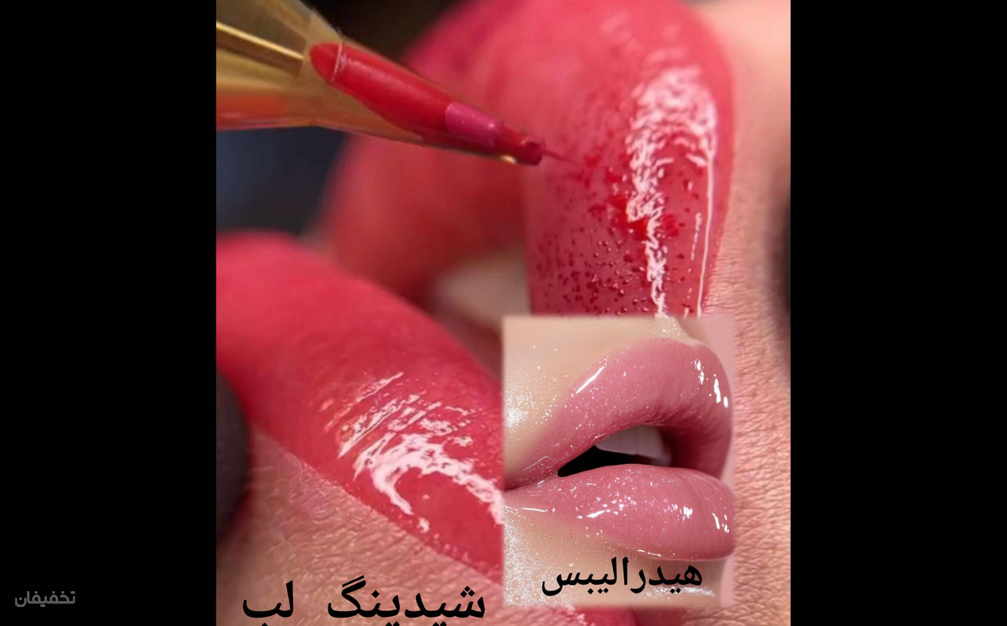 مرکز زیبایی مهربان بانوان و آقایان