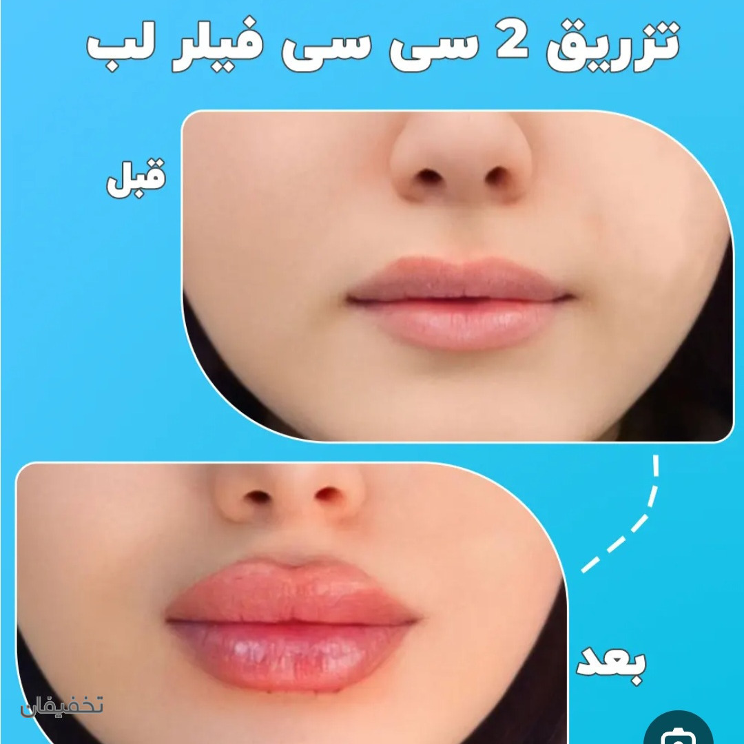 کلینیک زیبایی تیارا
