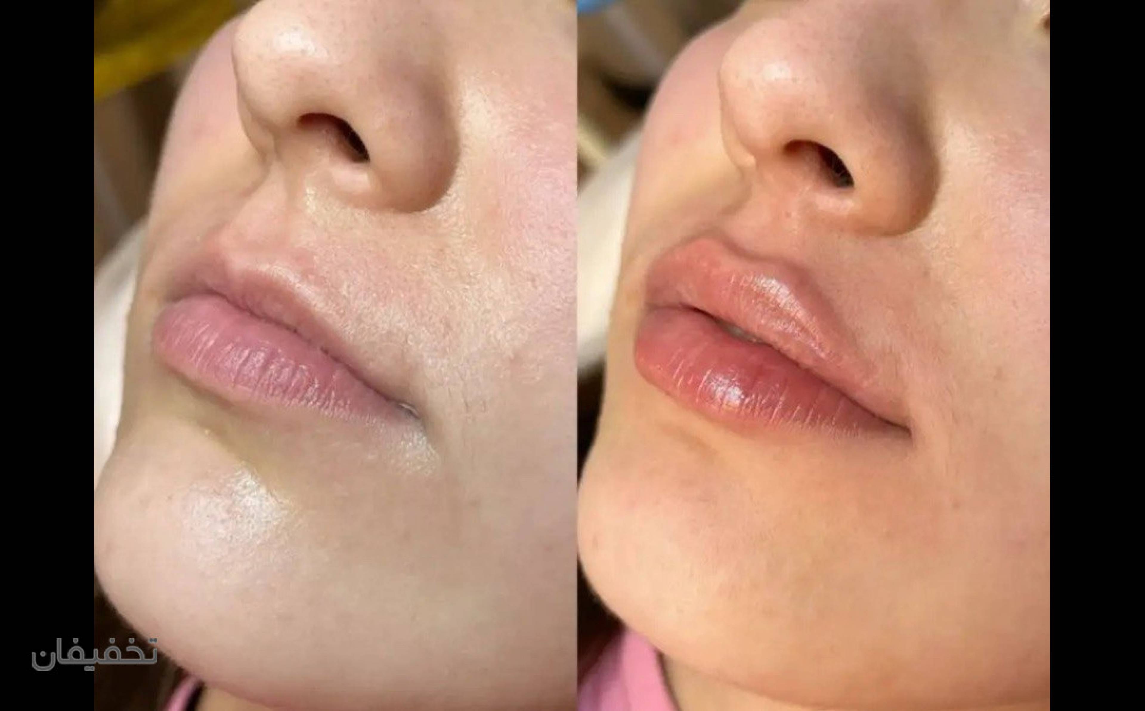 مرکز زیبایی و لاغری دمور