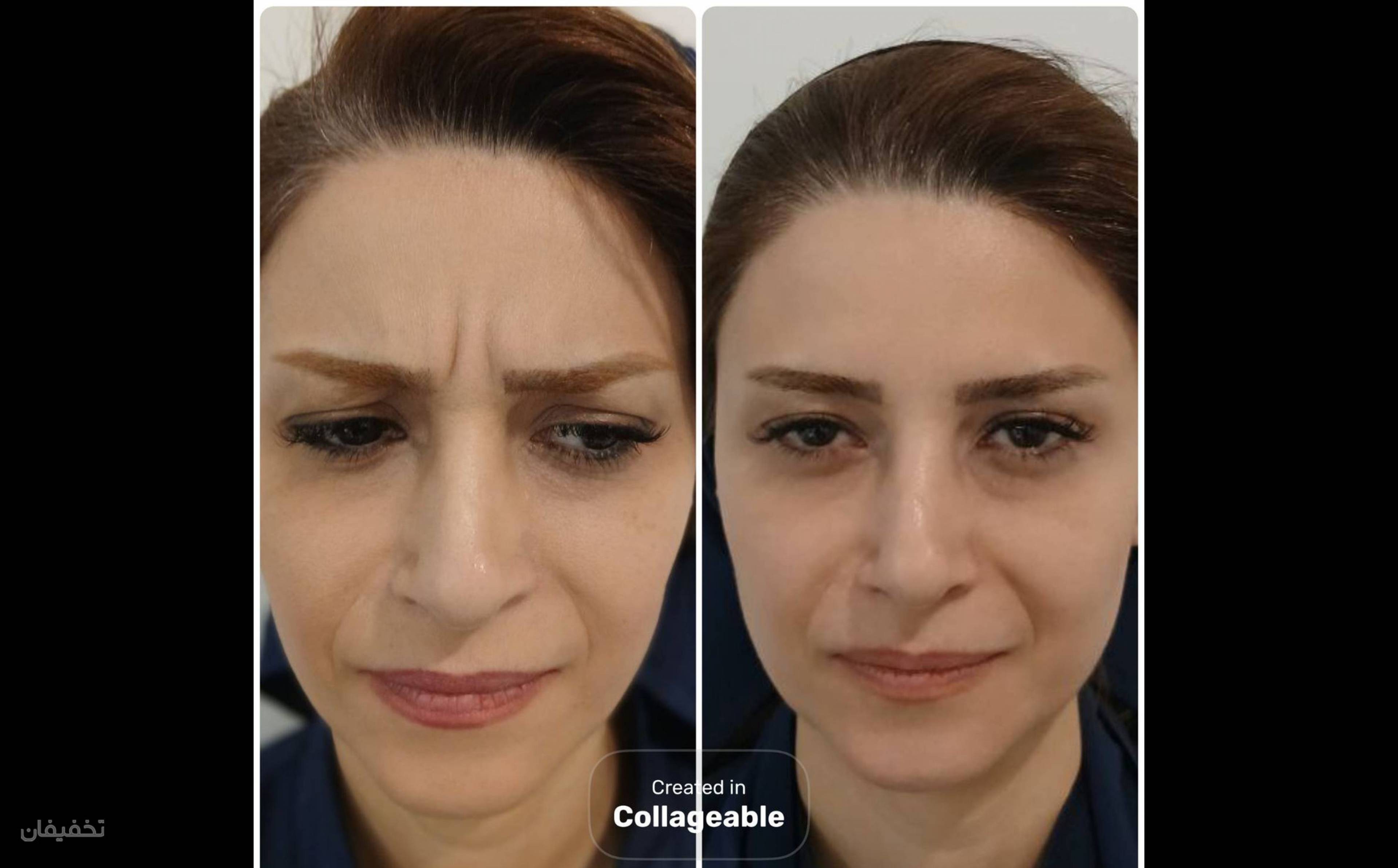 مرکز زیبایی و لاغری دمور
