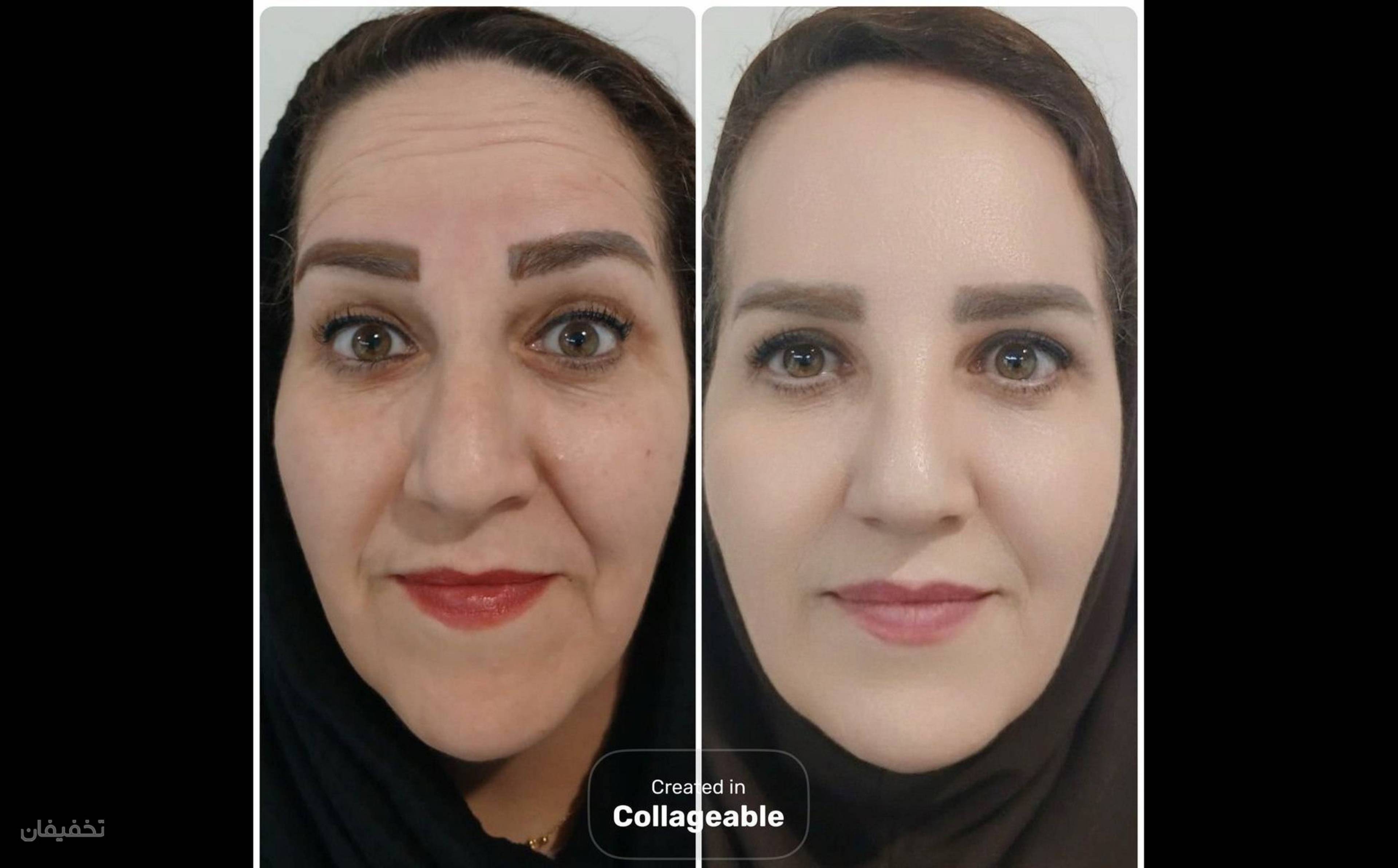 مرکز زیبایی و لاغری دمور