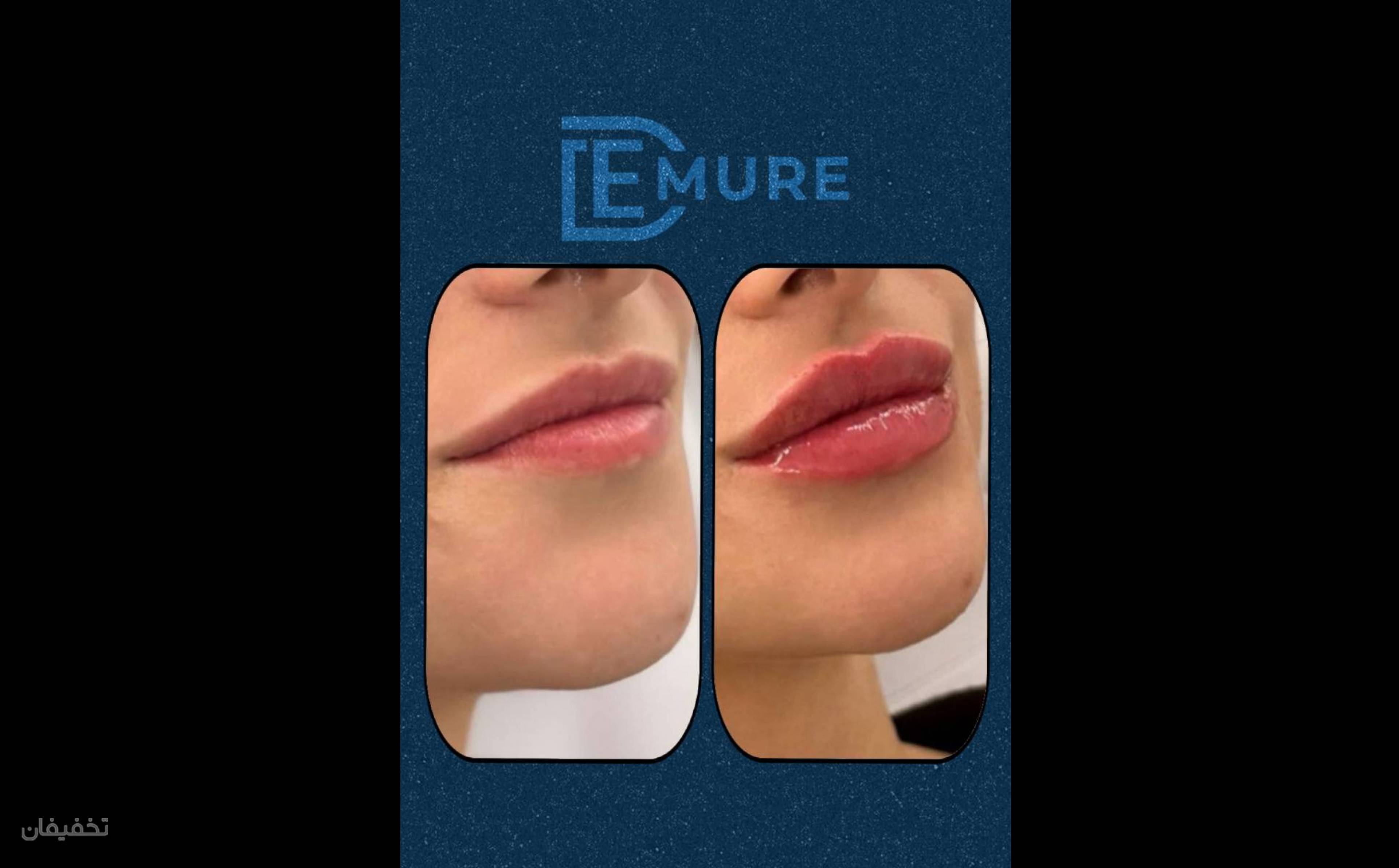 مرکز زیبایی و لاغری دمور