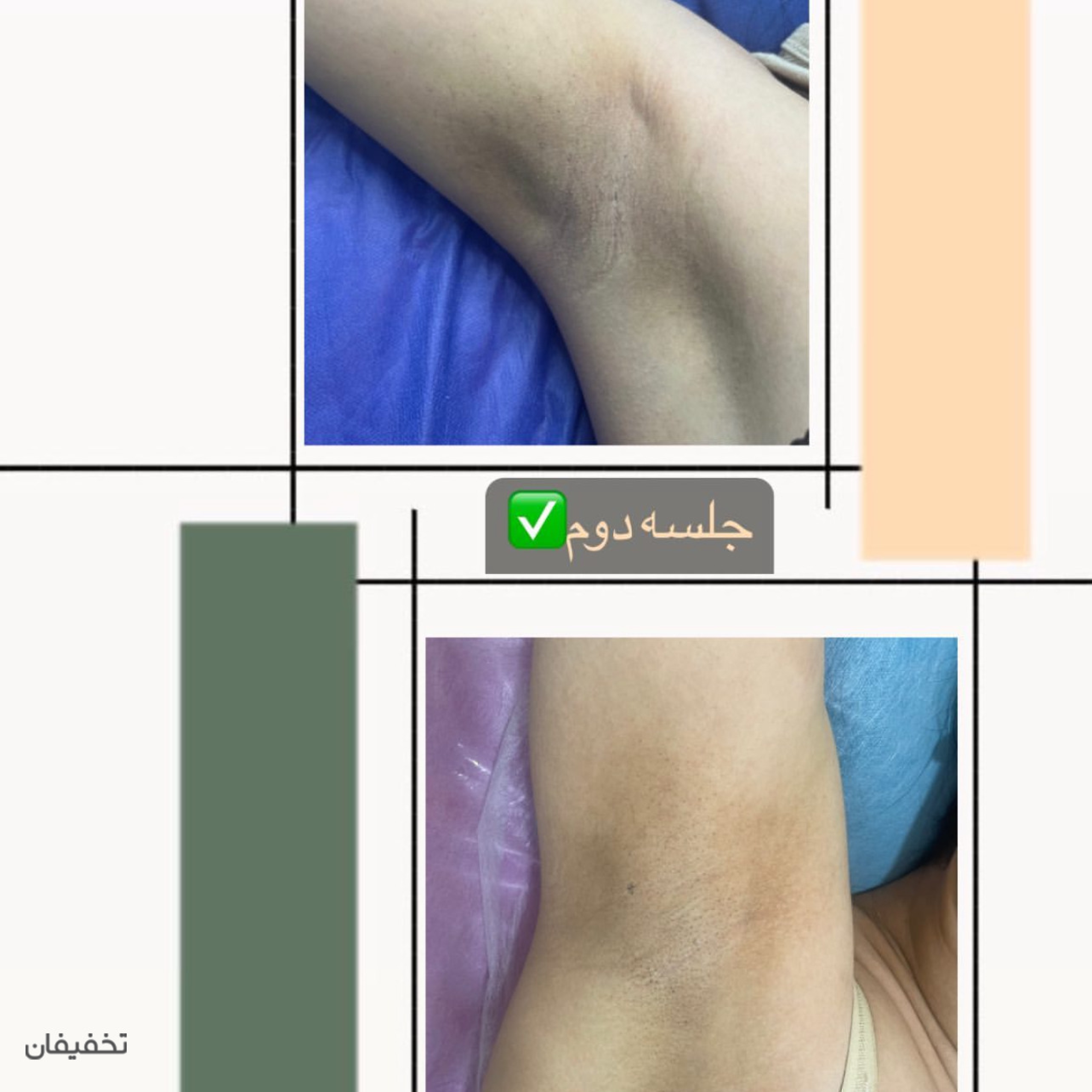 دکتر لیزر