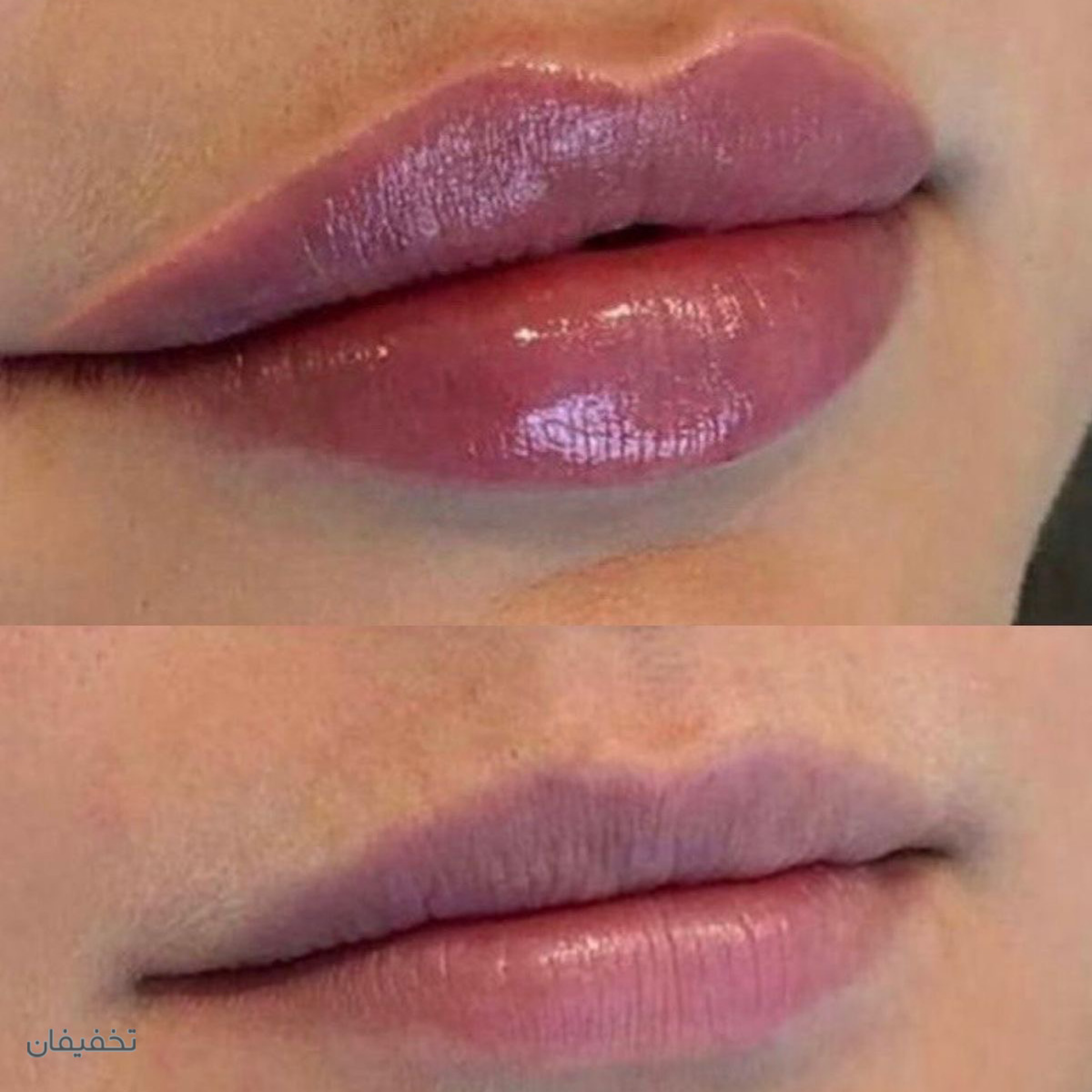 مطب پوست و زیبایی دکتر رنگیانی