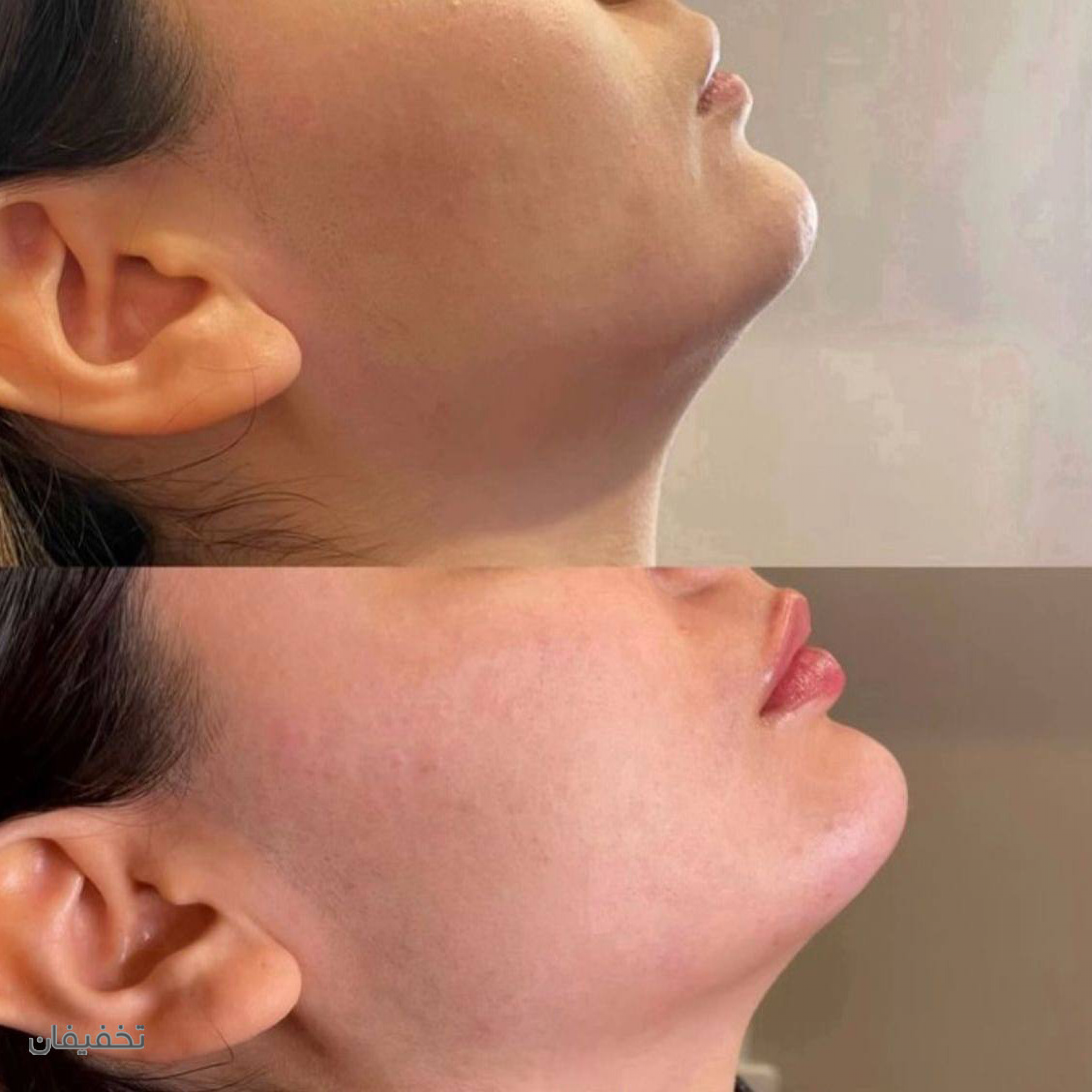مطب پوست و زیبایی دکتر رنگیانی