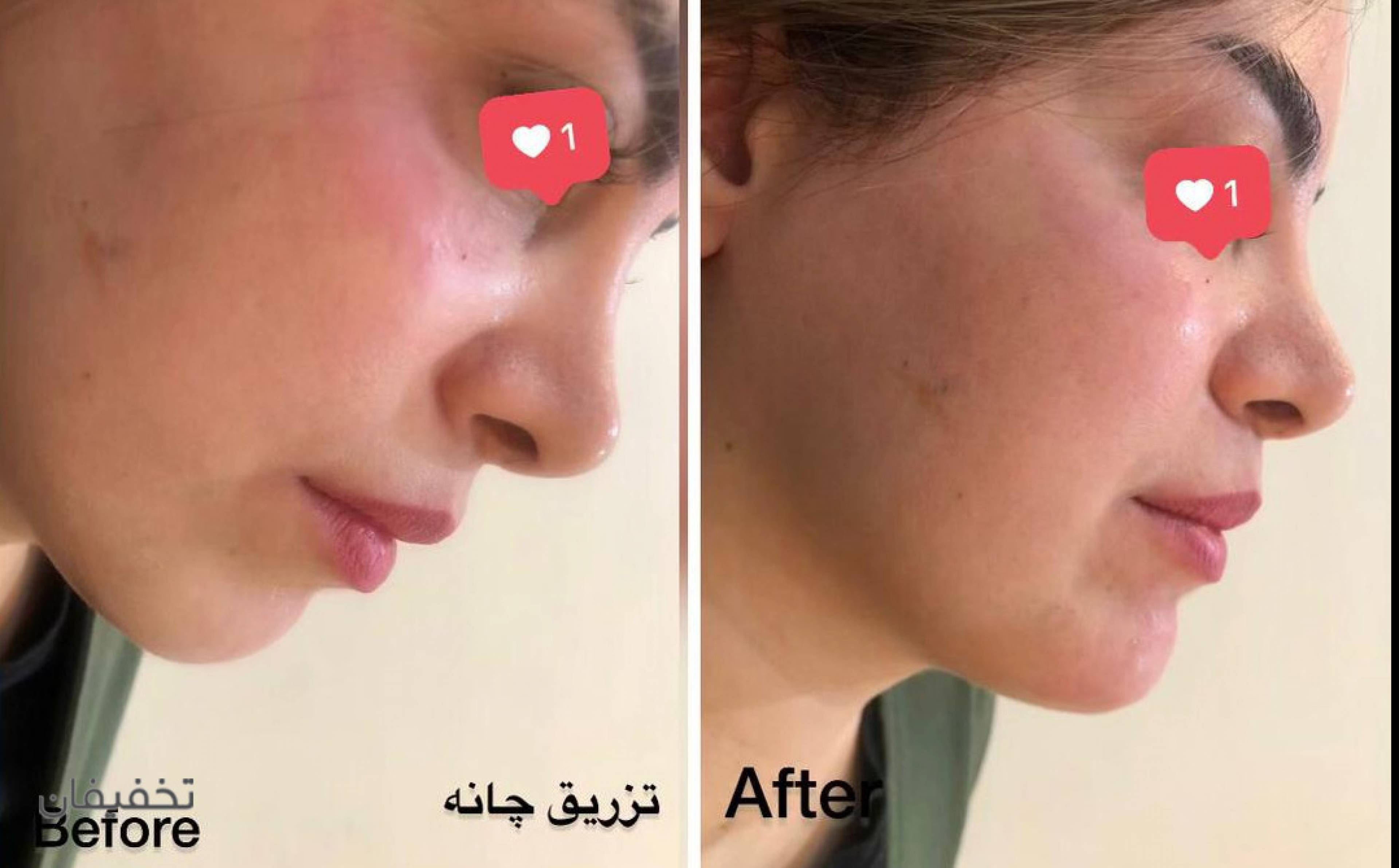 مرکز پوست و زیبایی نیلوفر آبی