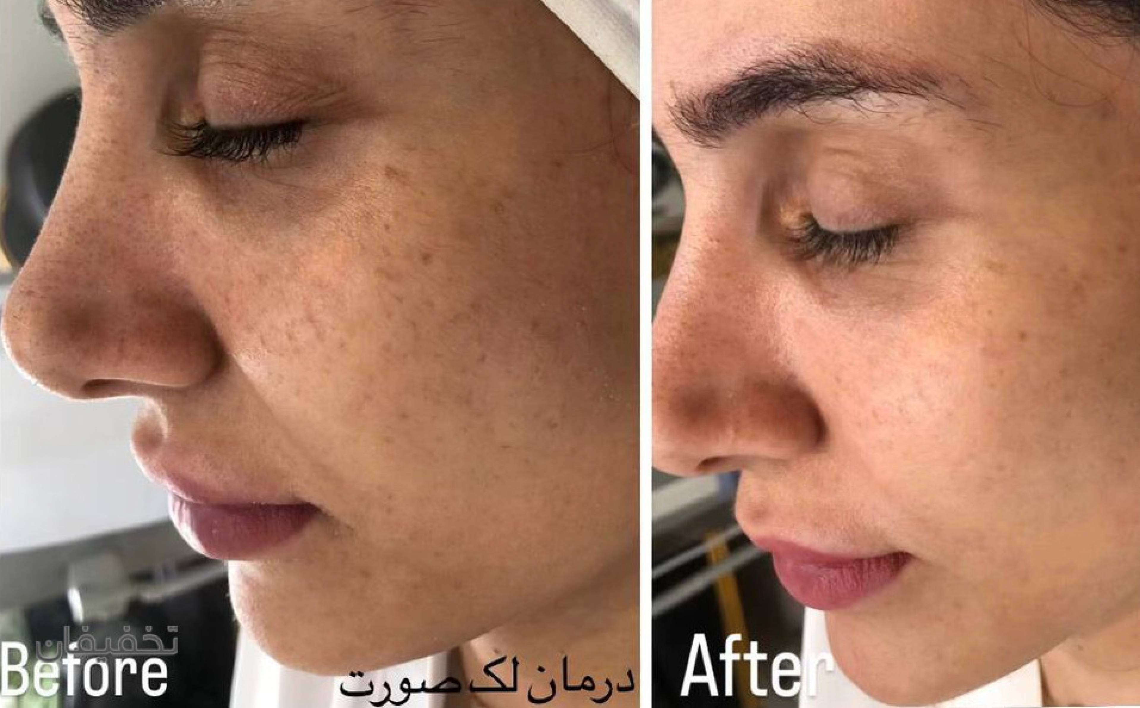 مرکز پوست و زیبایی نیلوفر آبی