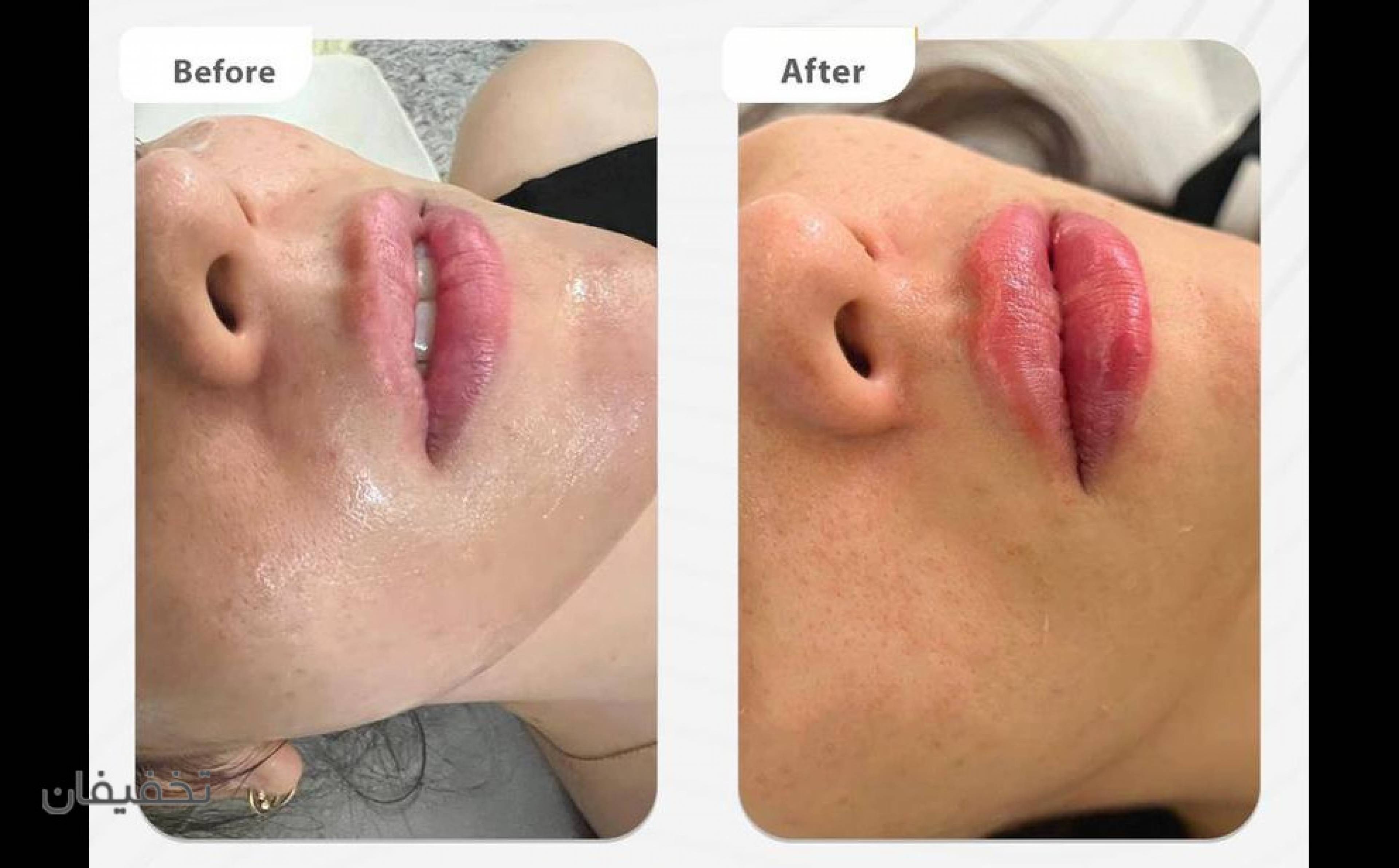 مطب دکتر بروجردی