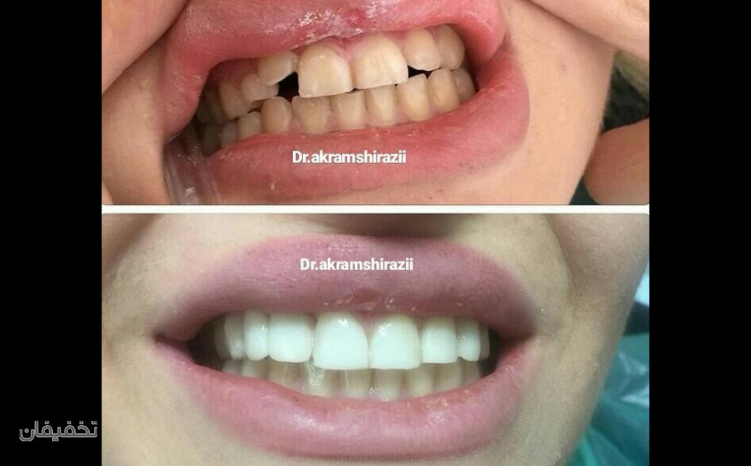 مرکز دندانپزشکی تخصصی دکتر اکرم شیرازی
