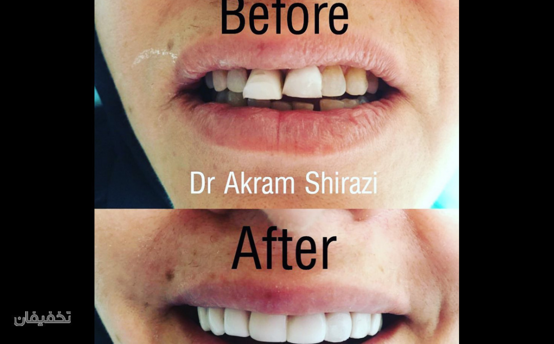 مرکز دندانپزشکی تخصصی دکتر اکرم شیرازی