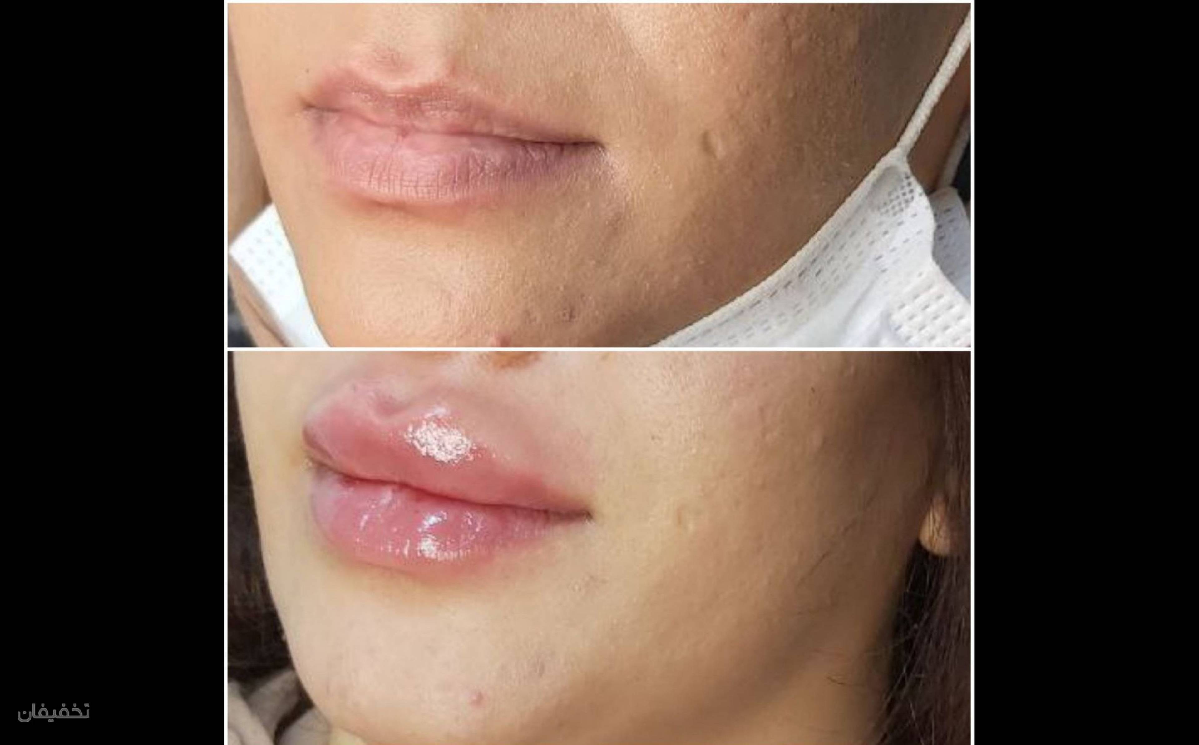 مرکز تخصصی لیزر و زیبایی کارا شعبه 1