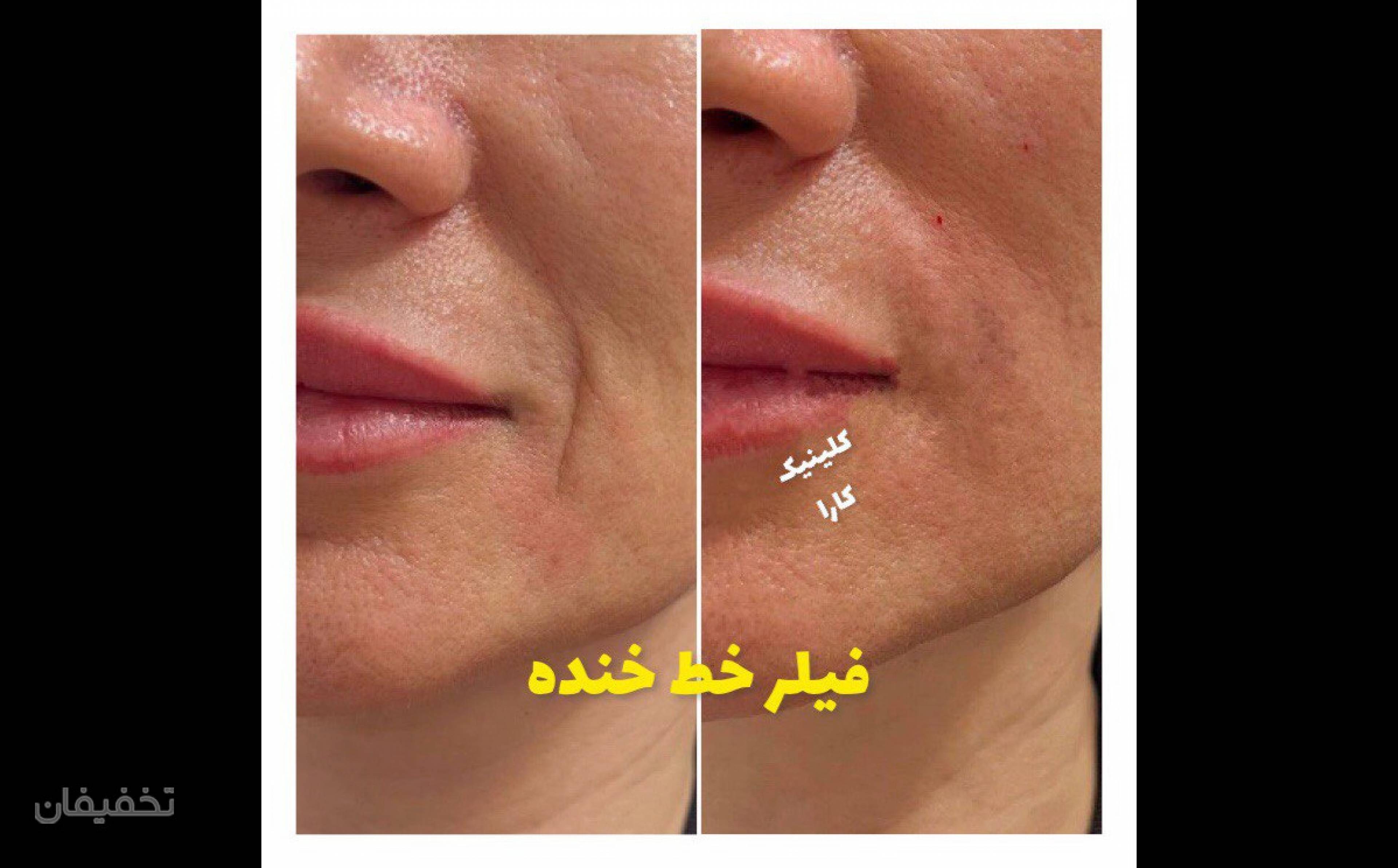 مرکز تخصصی لیزر و زیبایی کارا شعبه 1
