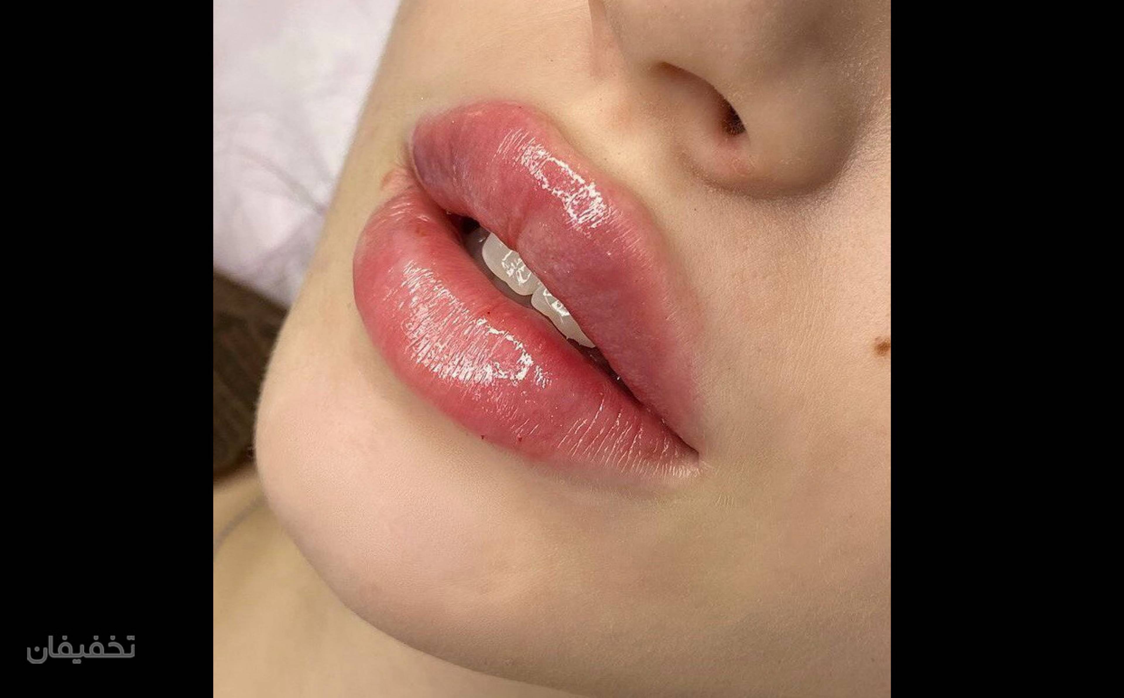 مرکز تخصصی لیزر و زیبایی کارا شعبه 1