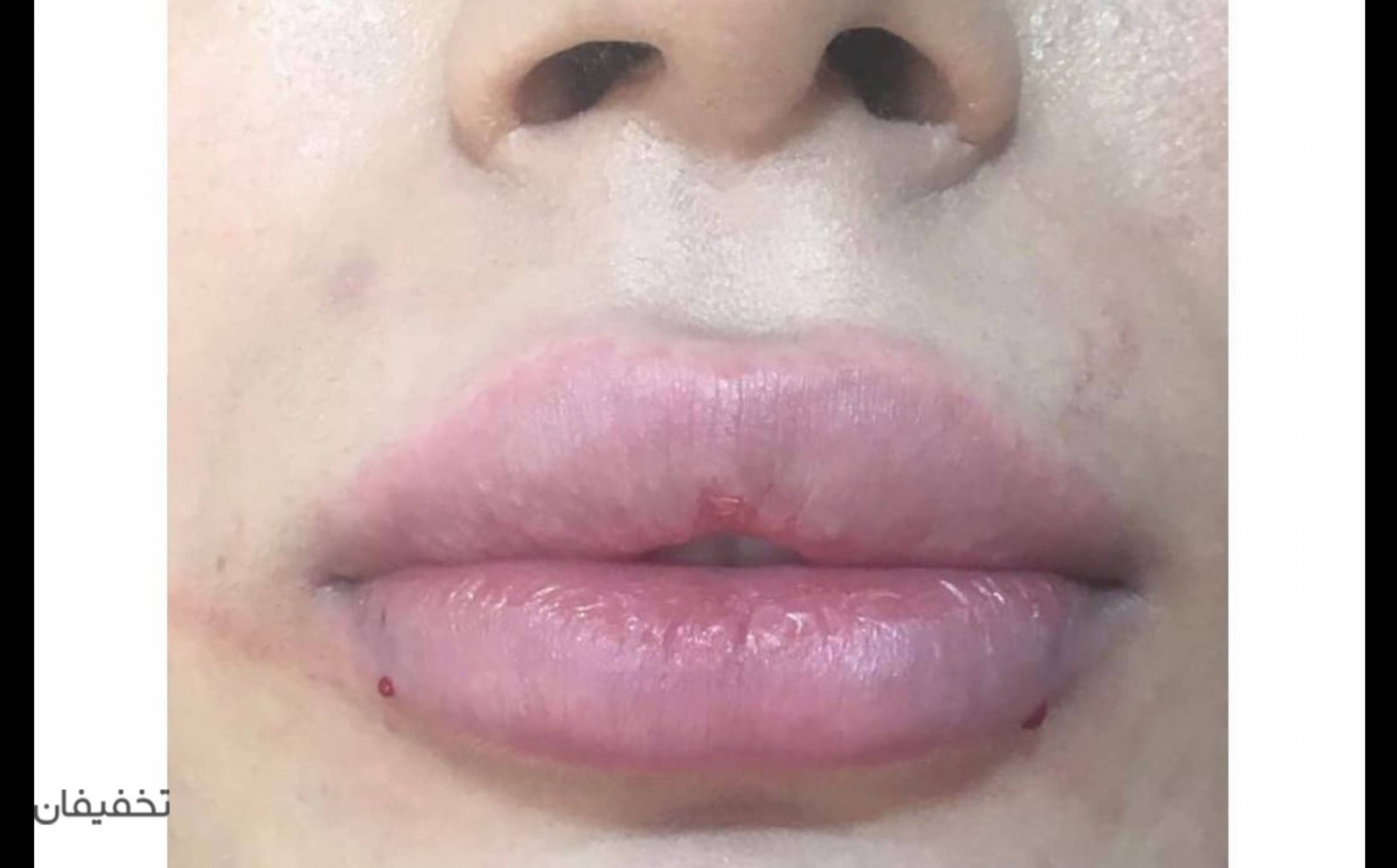 مطب دکتر محققی
