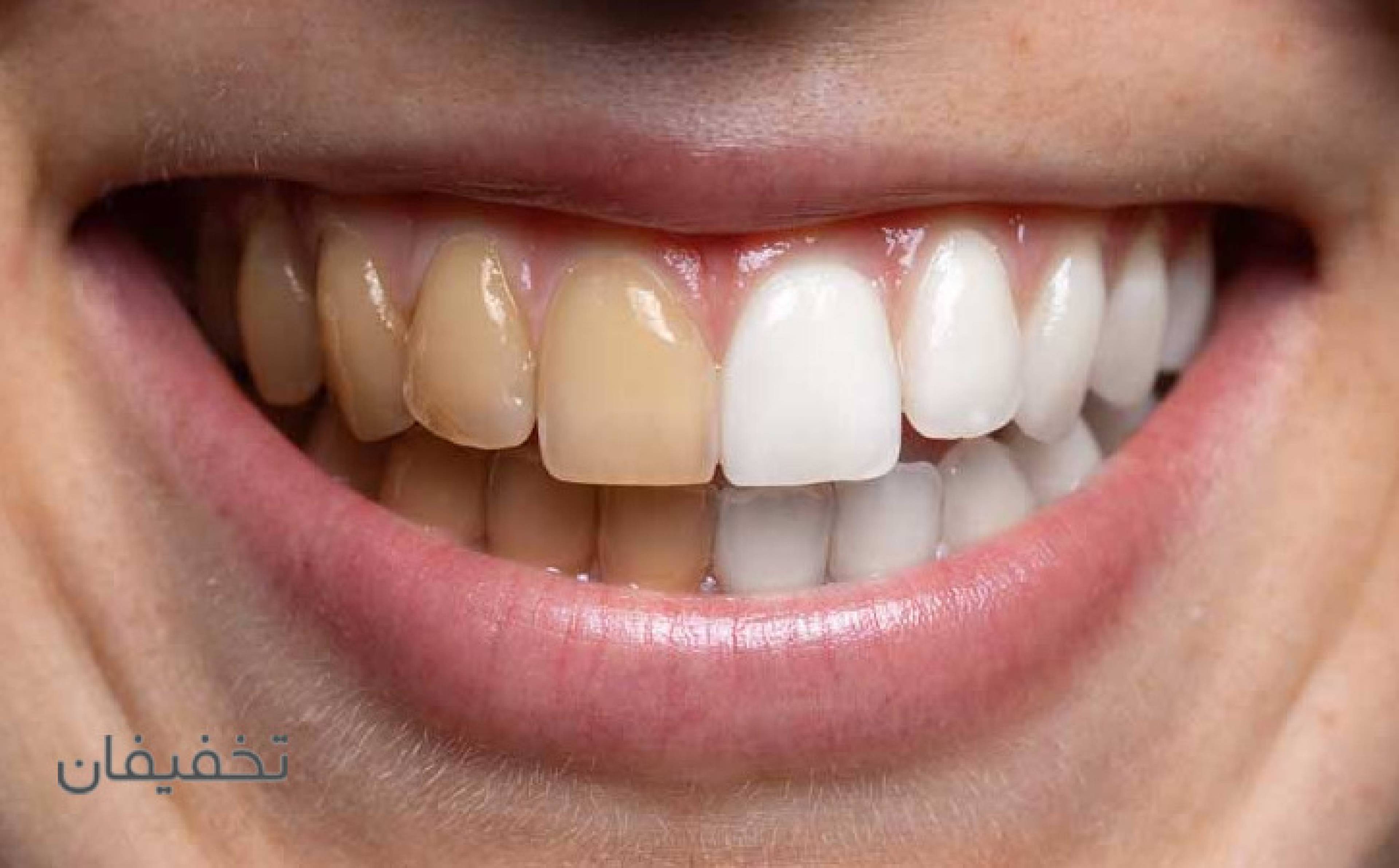 دندانپزشکی ژکوند