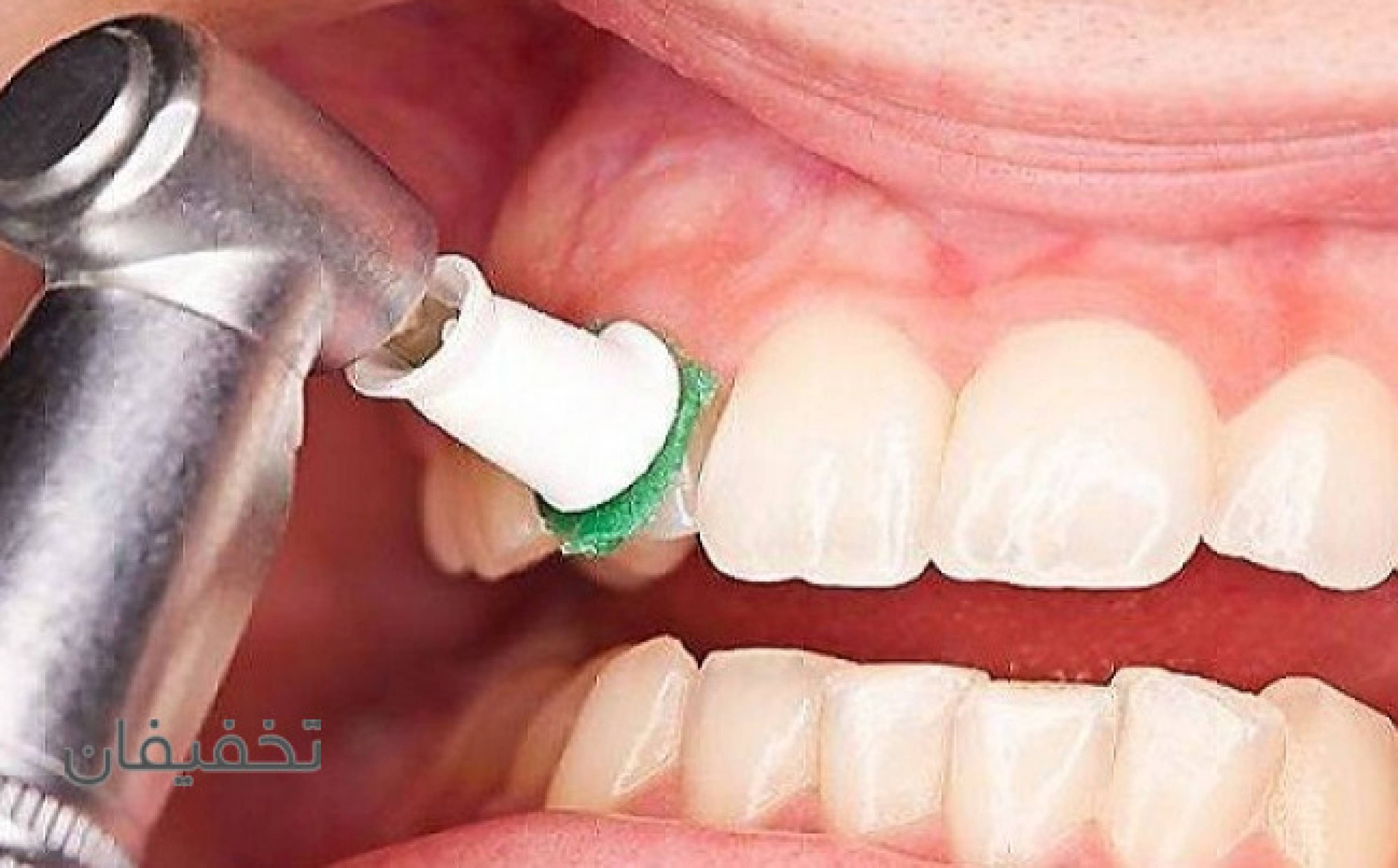 دندانپزشکی ژکوند