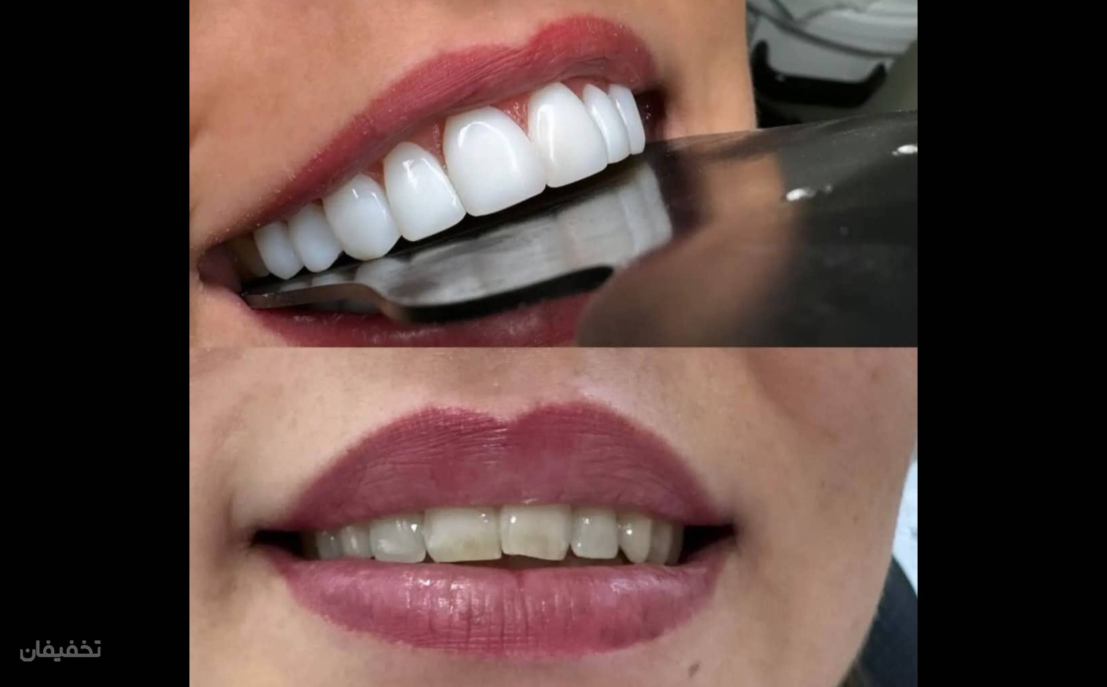 مطب دندانپزشکی دکتر حمزه ای و ایمپلنت جراح و متخصص فک و صورت