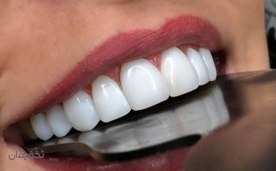 مطب دندانپزشکی دکتر حمزه ای و ایمپلنت جراح و متخصص فک و صورت