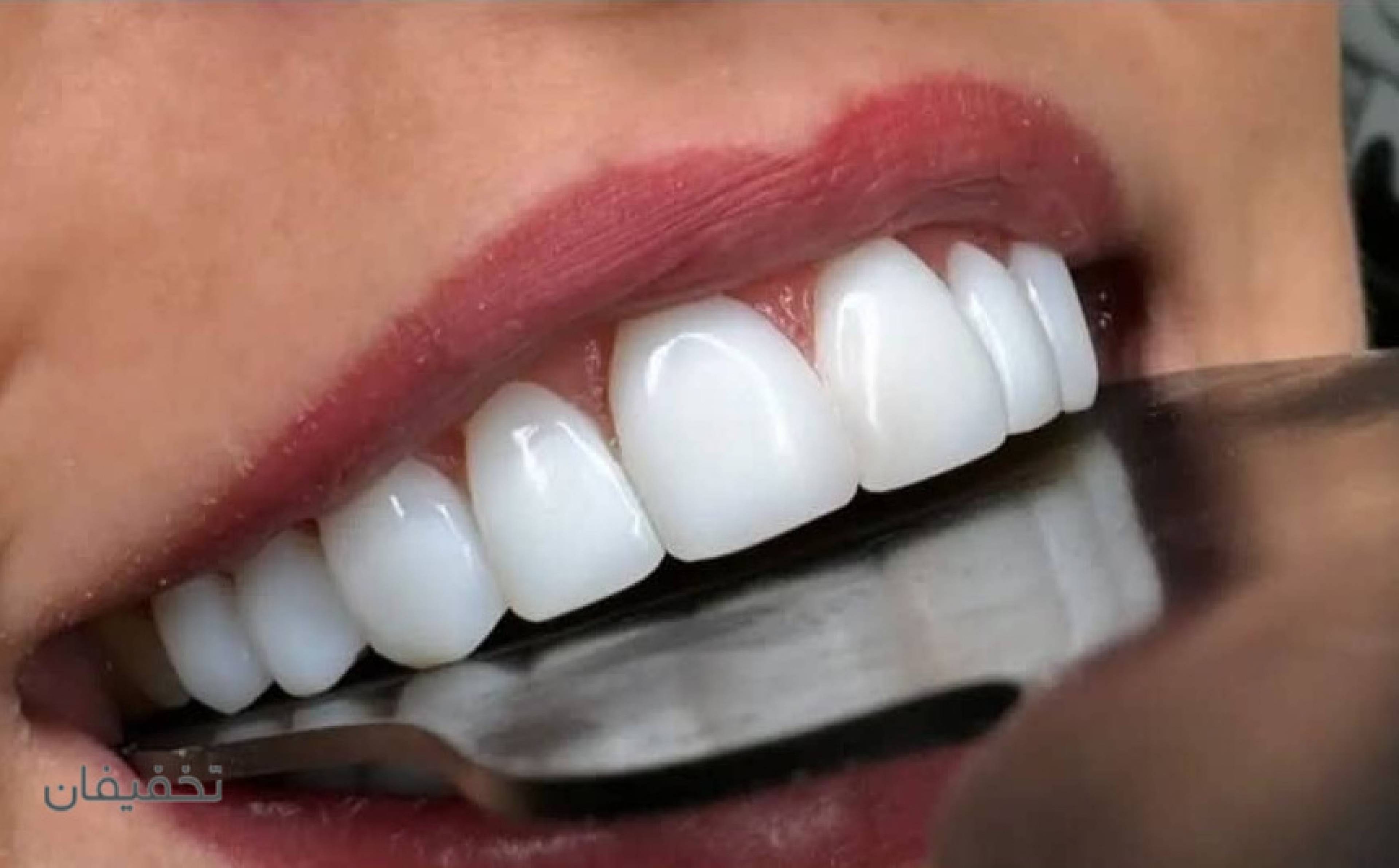 مطب دندانپزشکی دکتر حمزه ای و ایمپلنت جراح و متخصص فک و صورت