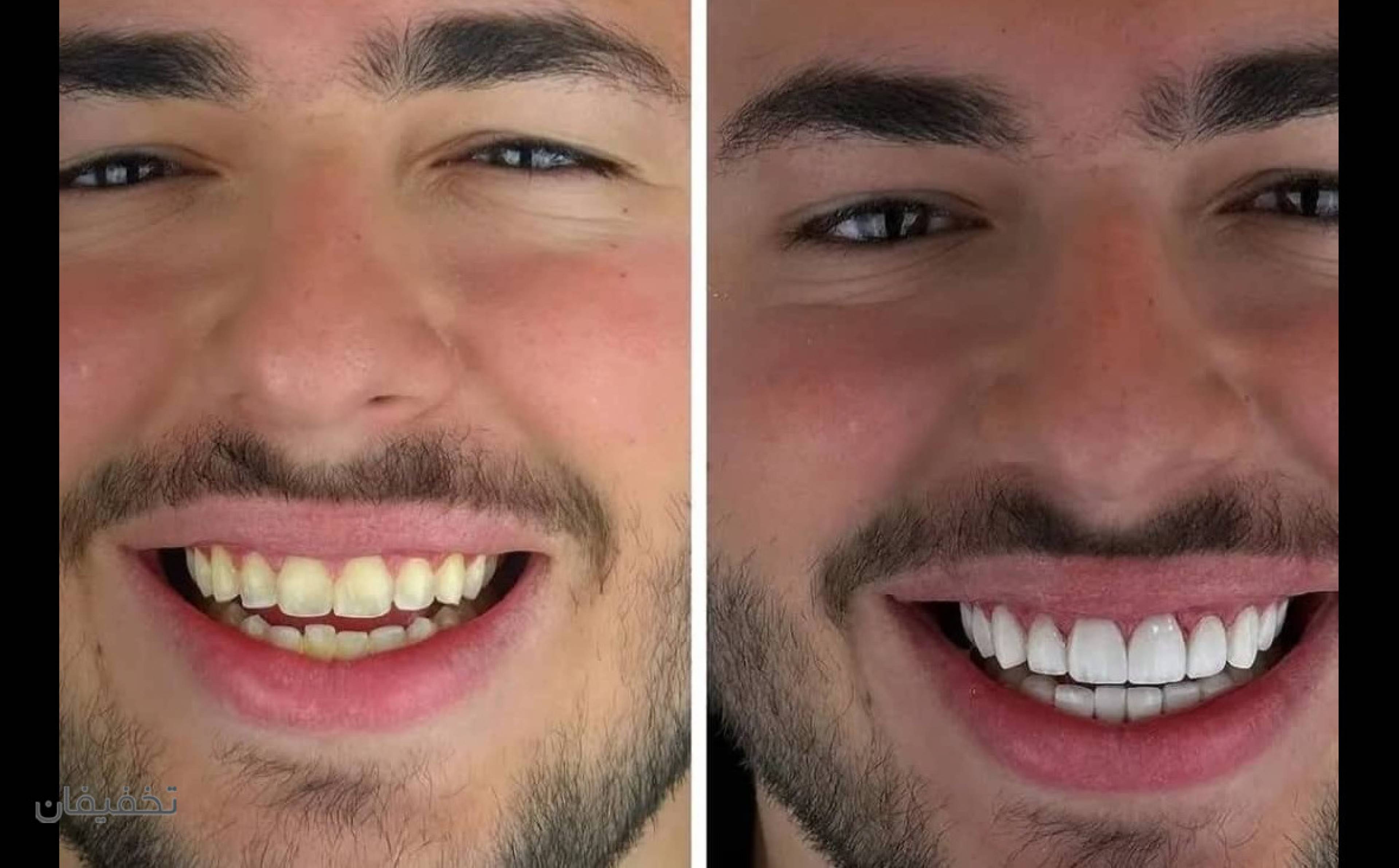 مطب دندانپزشکی دکتر حمزه ای و ایمپلنت جراح و متخصص فک و صورت