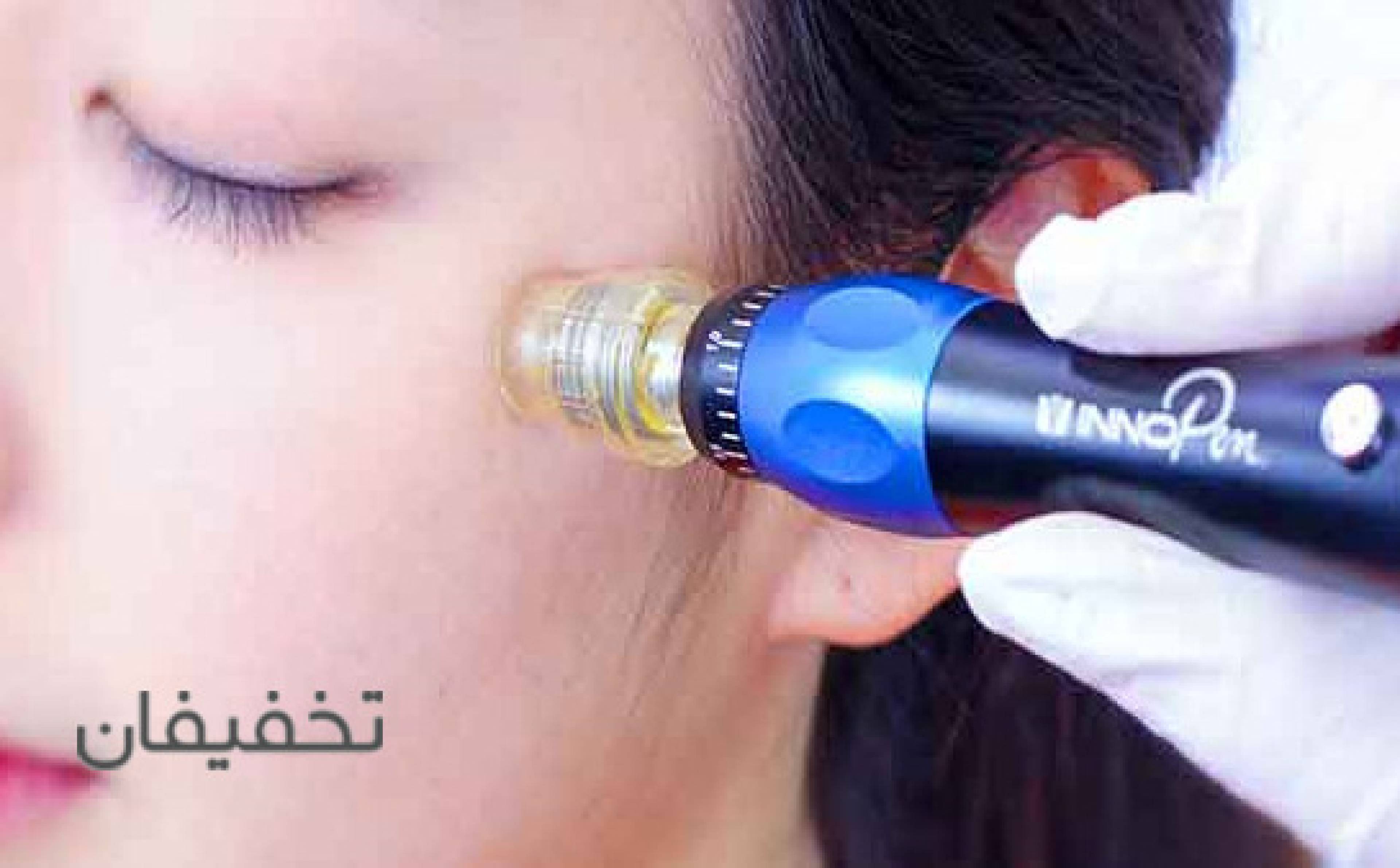 مطب بهبودی
