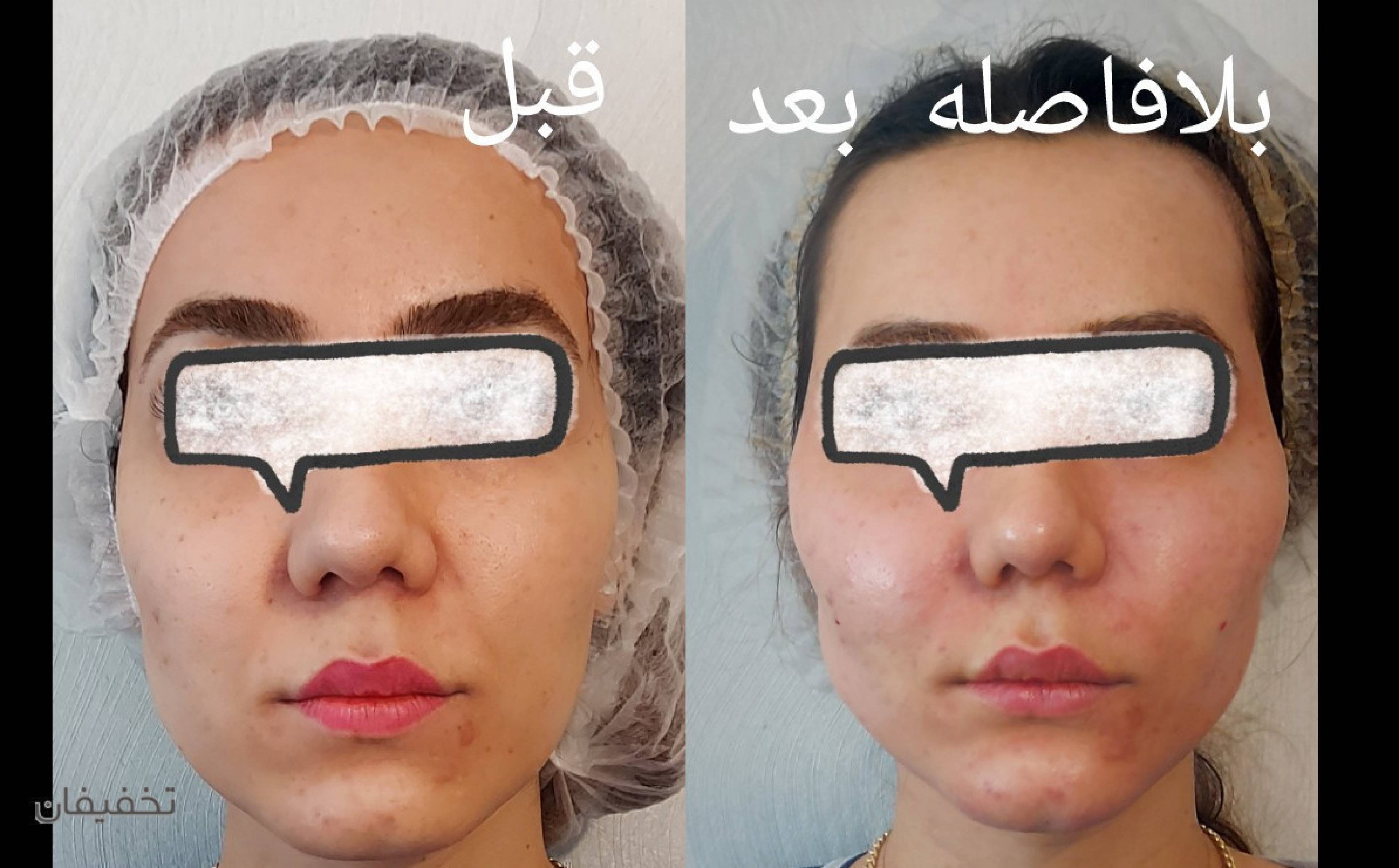 کلینیک زیبایی پوست ومو دکتر لیلی هاشمی