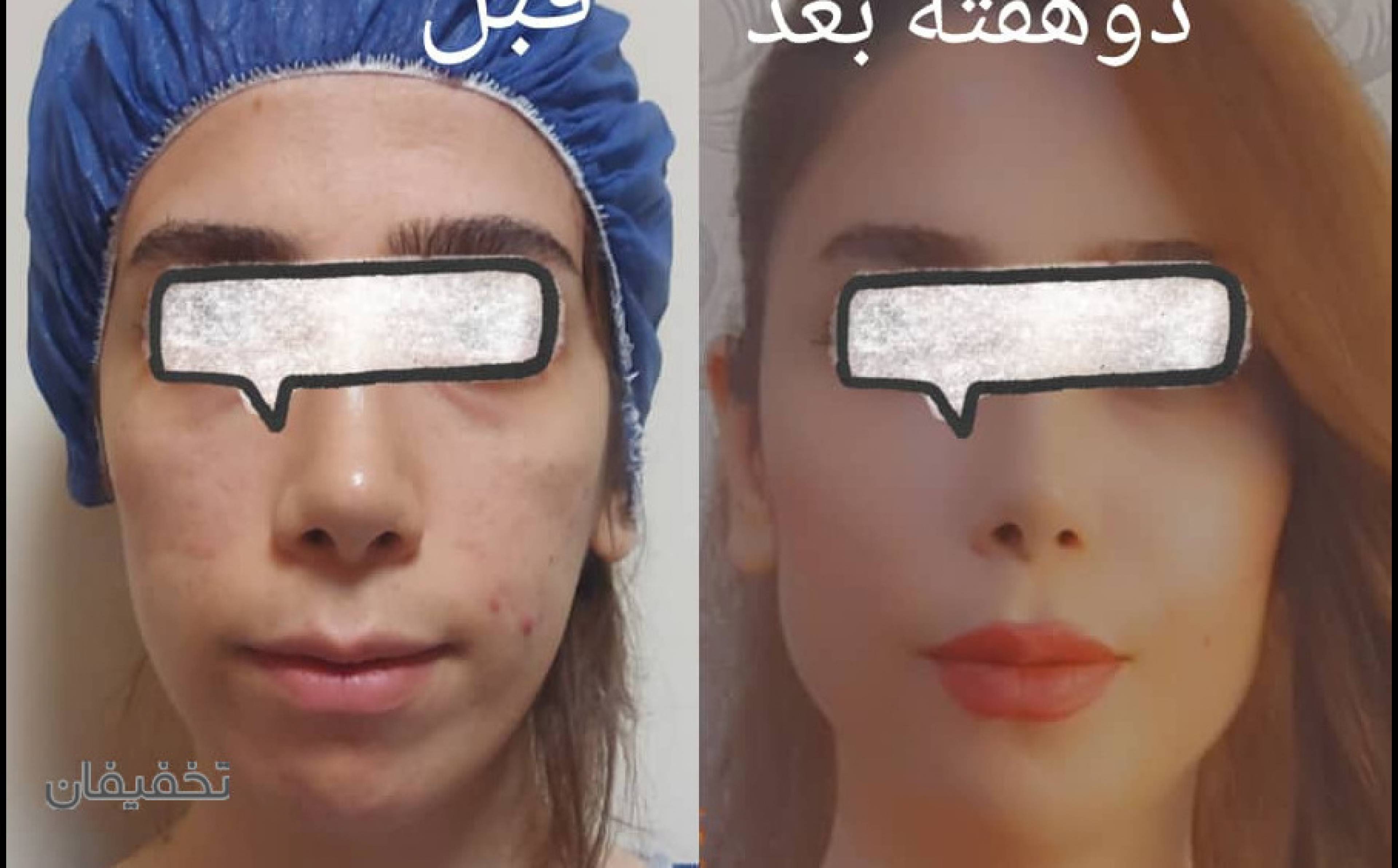 کلینیک زیبایی پوست ومو دکتر لیلی هاشمی