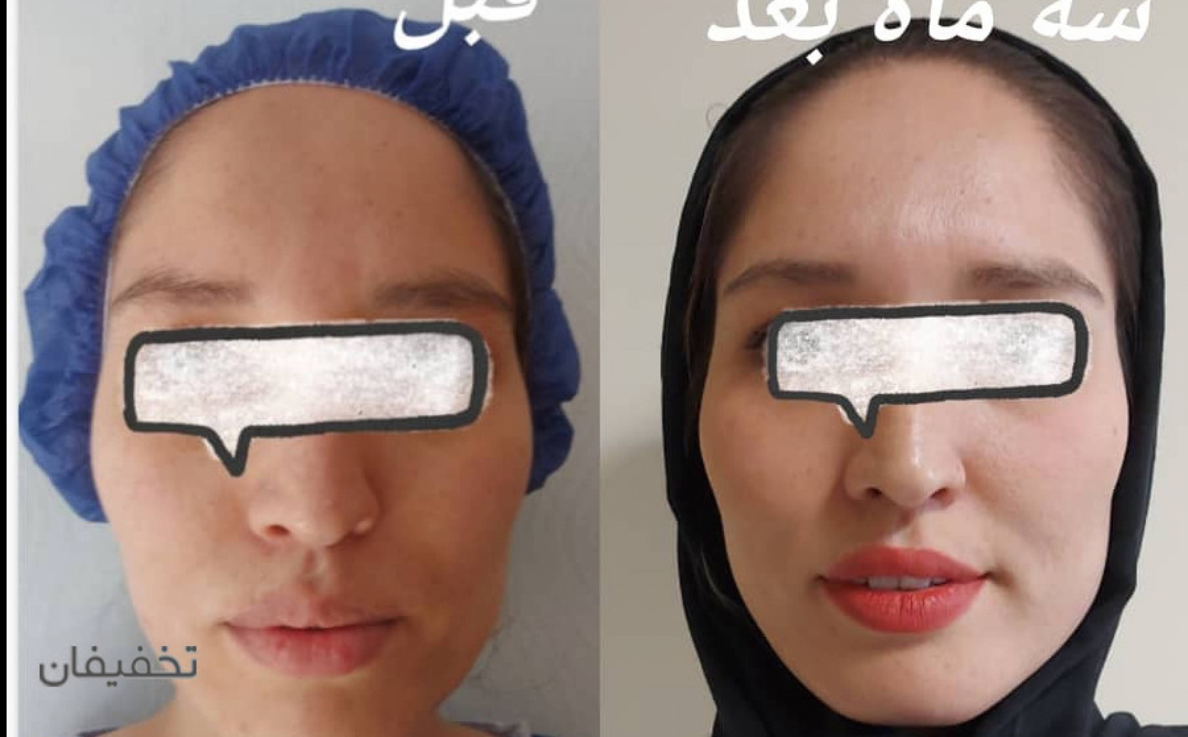 کلینیک زیبایی پوست ومو دکتر لیلی هاشمی