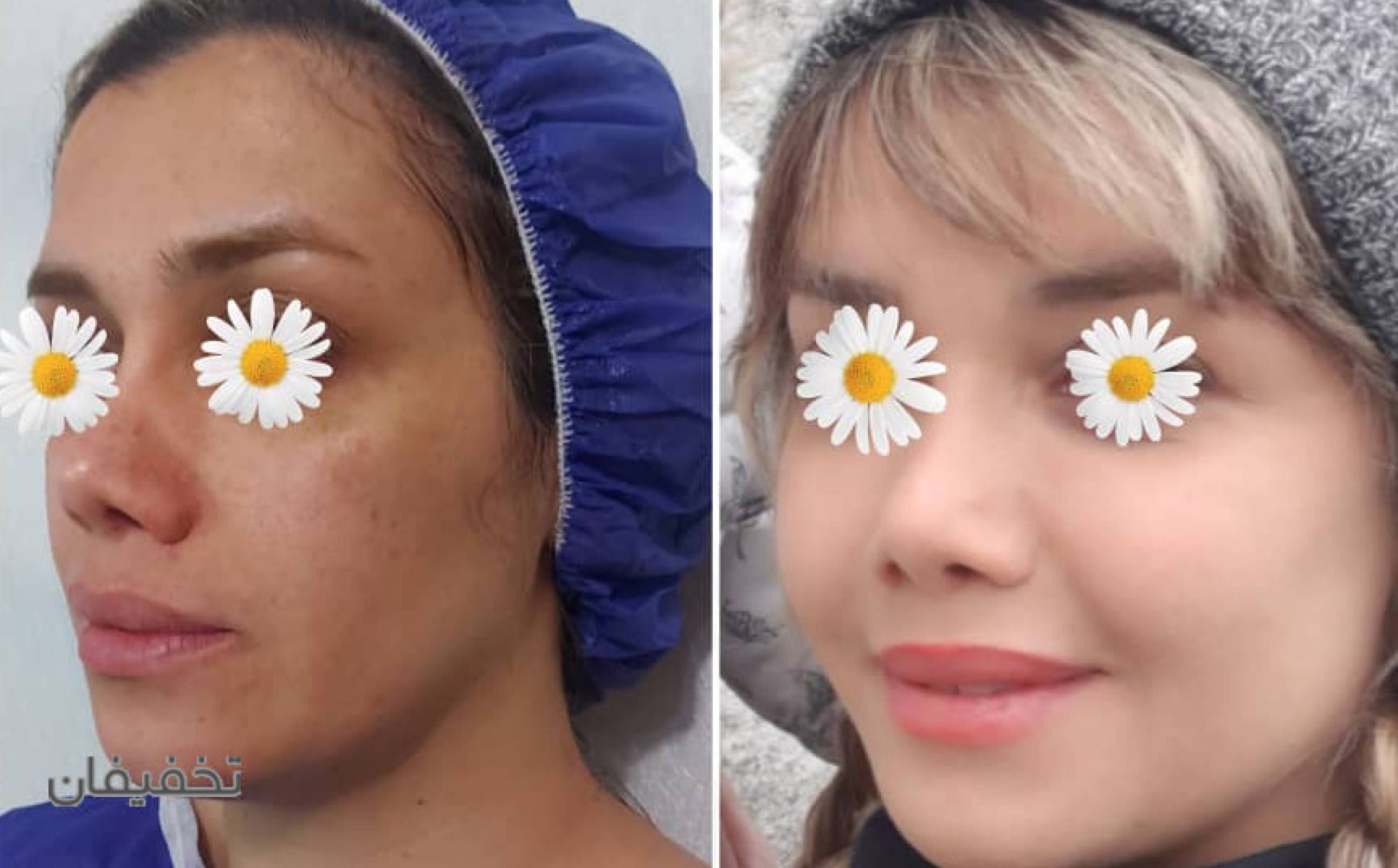 کلینیک زیبایی پوست ومو دکتر لیلی هاشمی