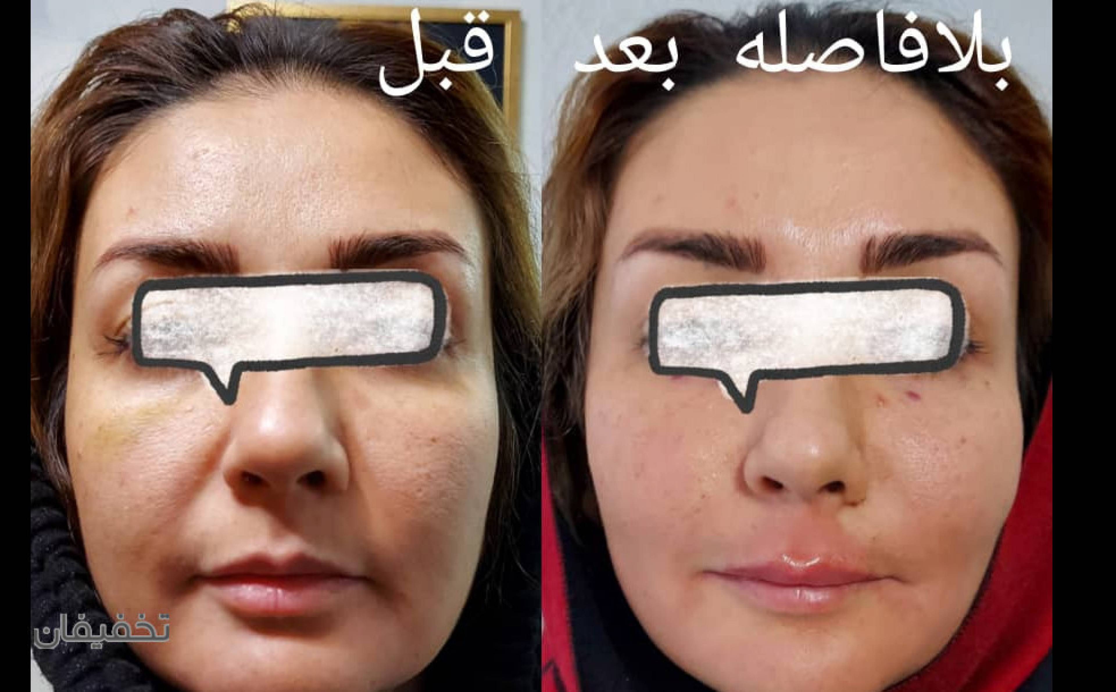 کلینیک زیبایی پوست ومو دکتر لیلی هاشمی