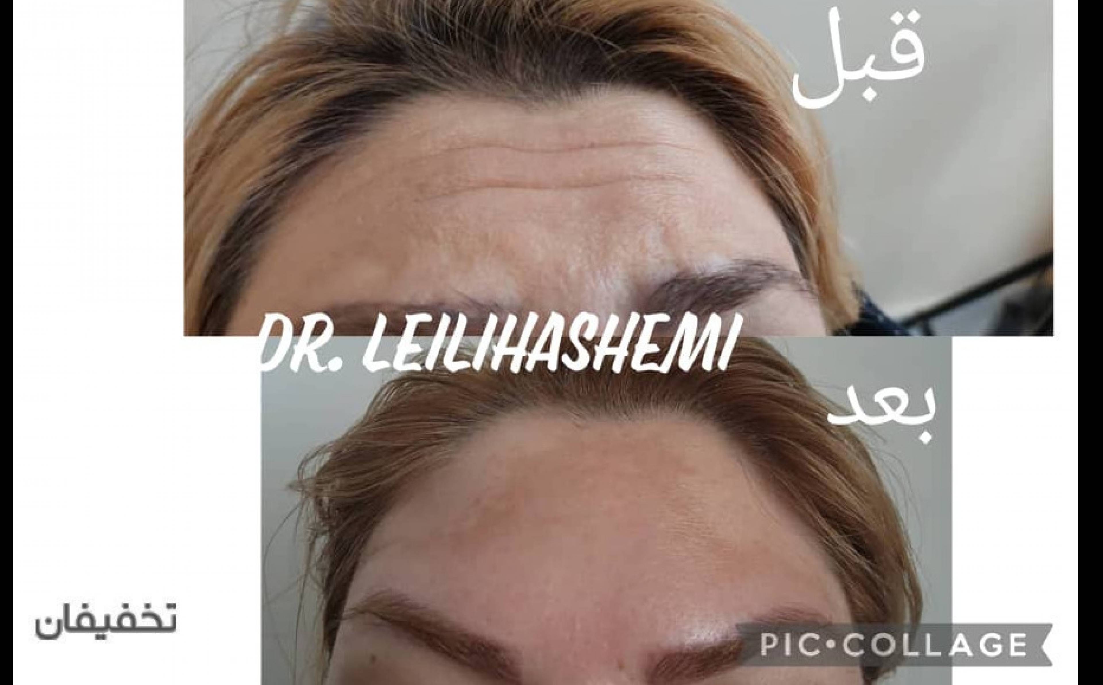 کلینیک زیبایی پوست ومو دکتر لیلی هاشمی