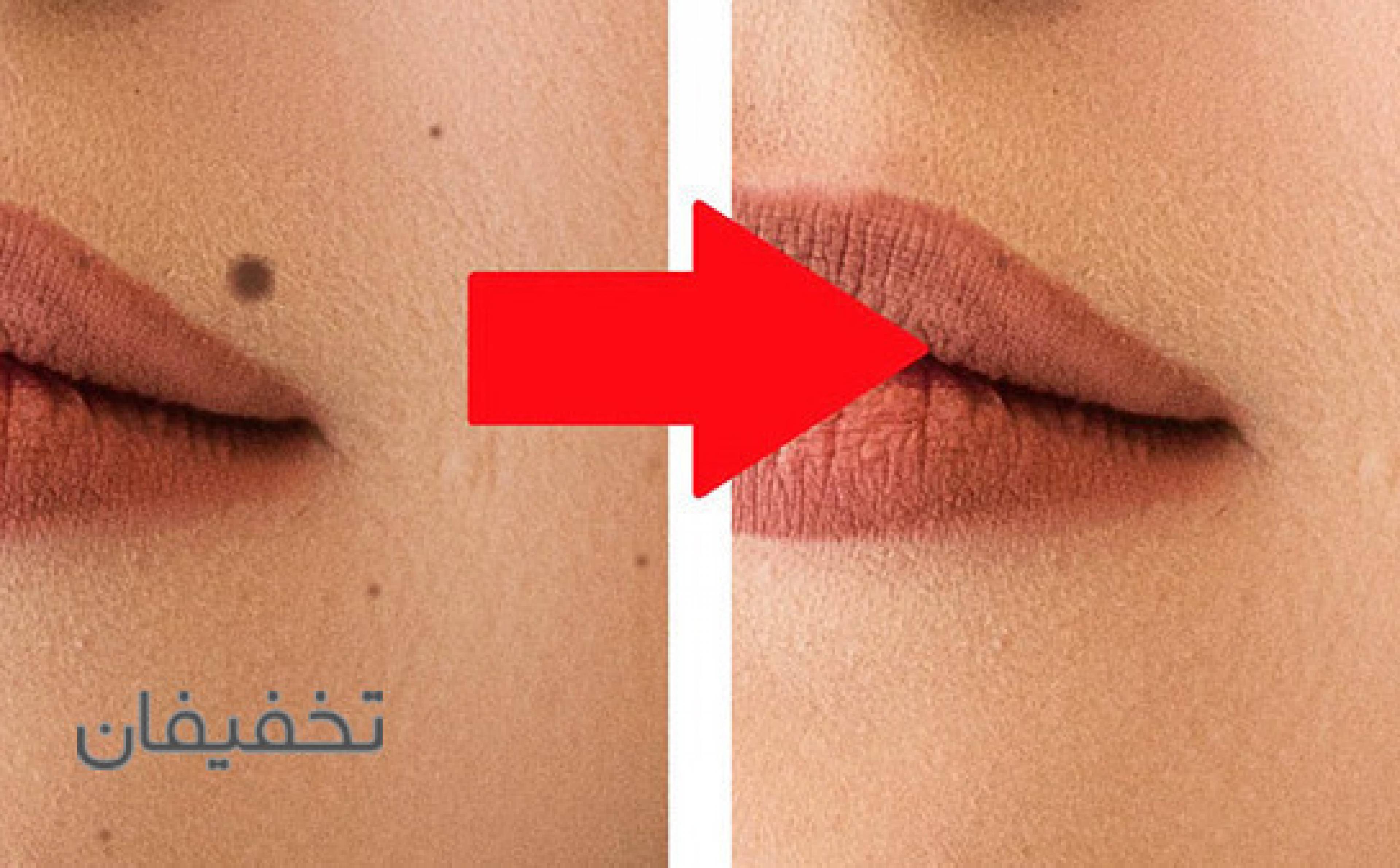 مطب پوست و مو دکتر فرهادی