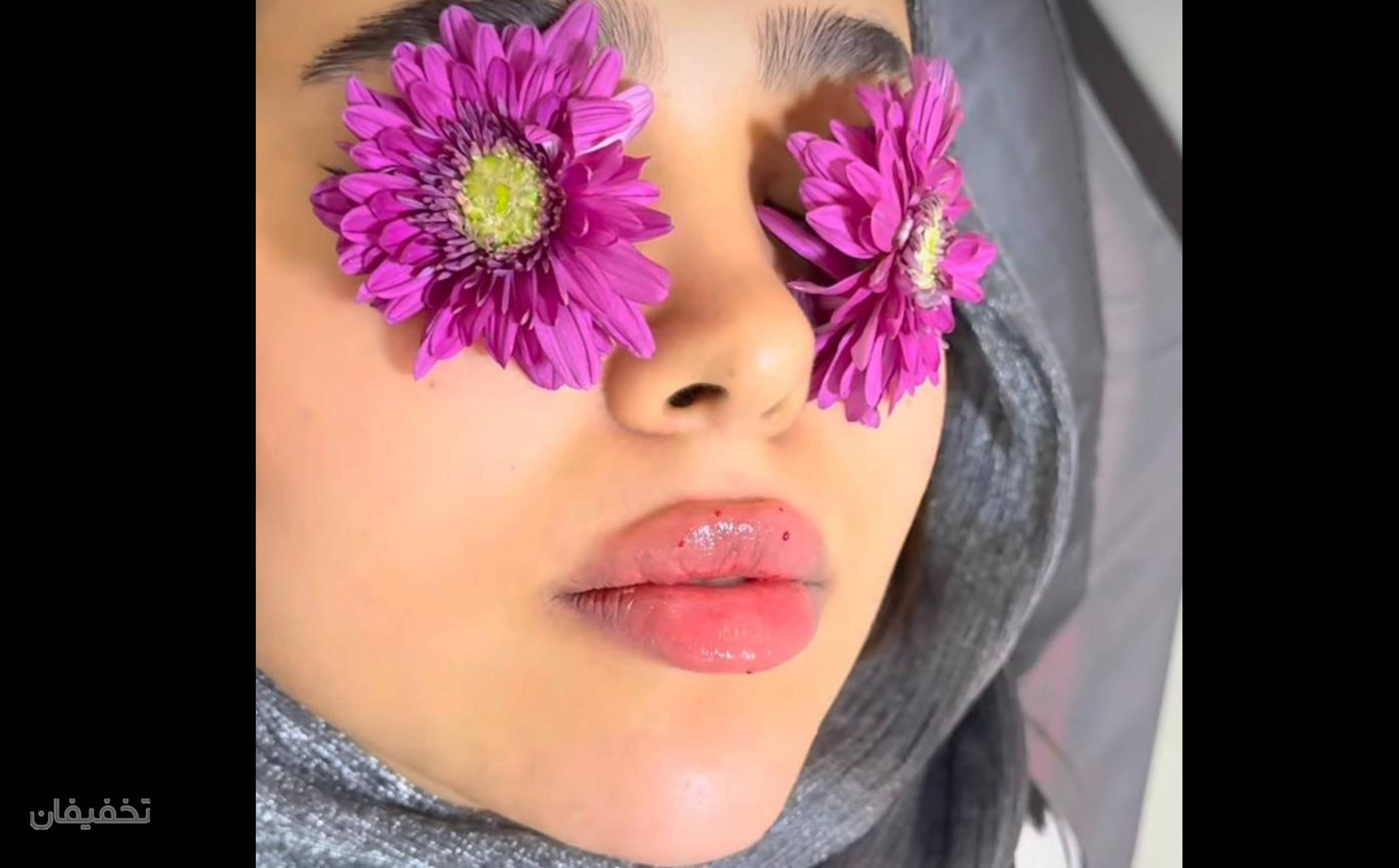 لیزر اسکلپیون مدیو استار و کندلا در مرکز ثنا