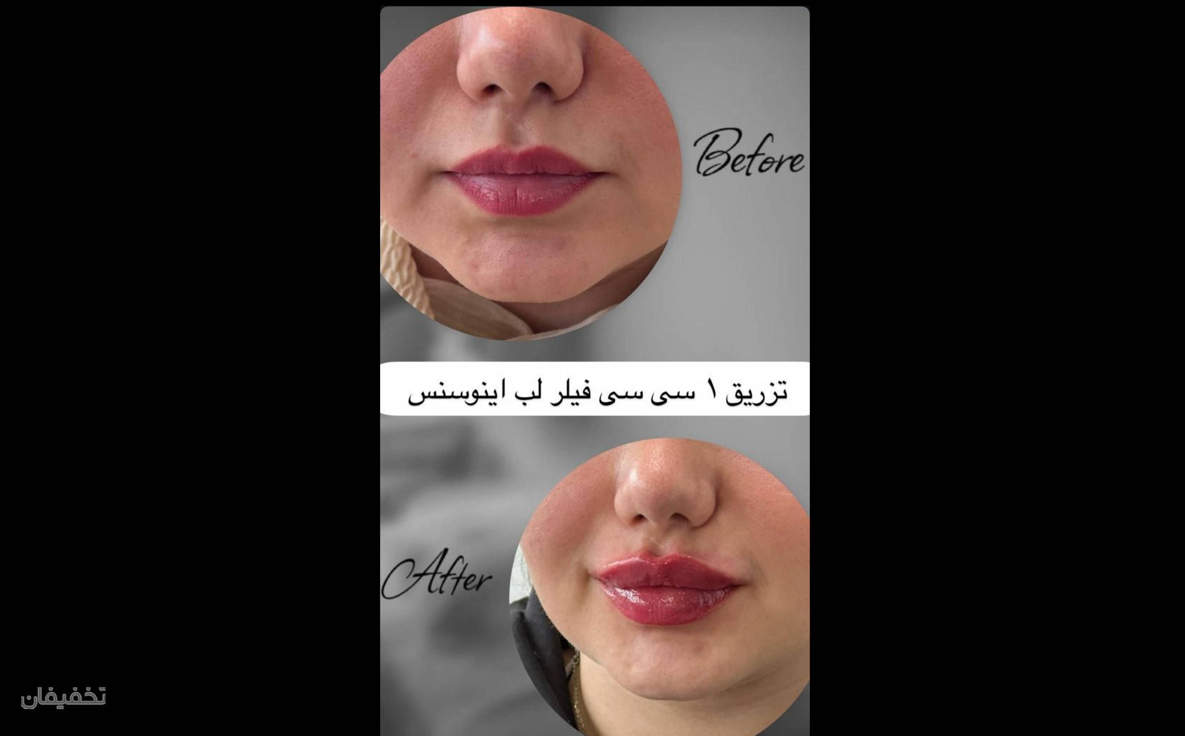 کلینیک زیبایی زارا