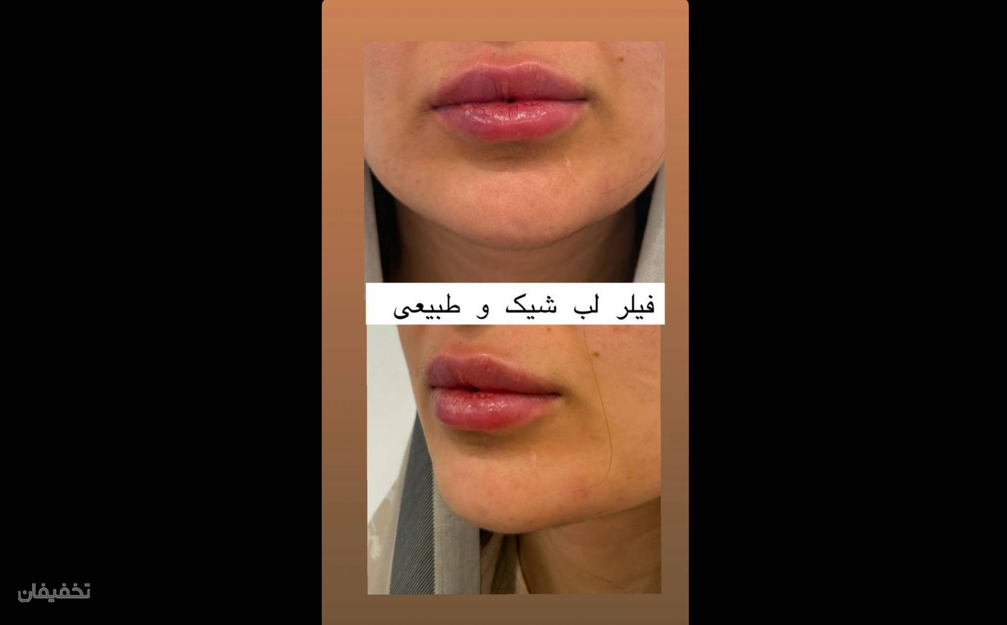کلینیک زیبایی زارا