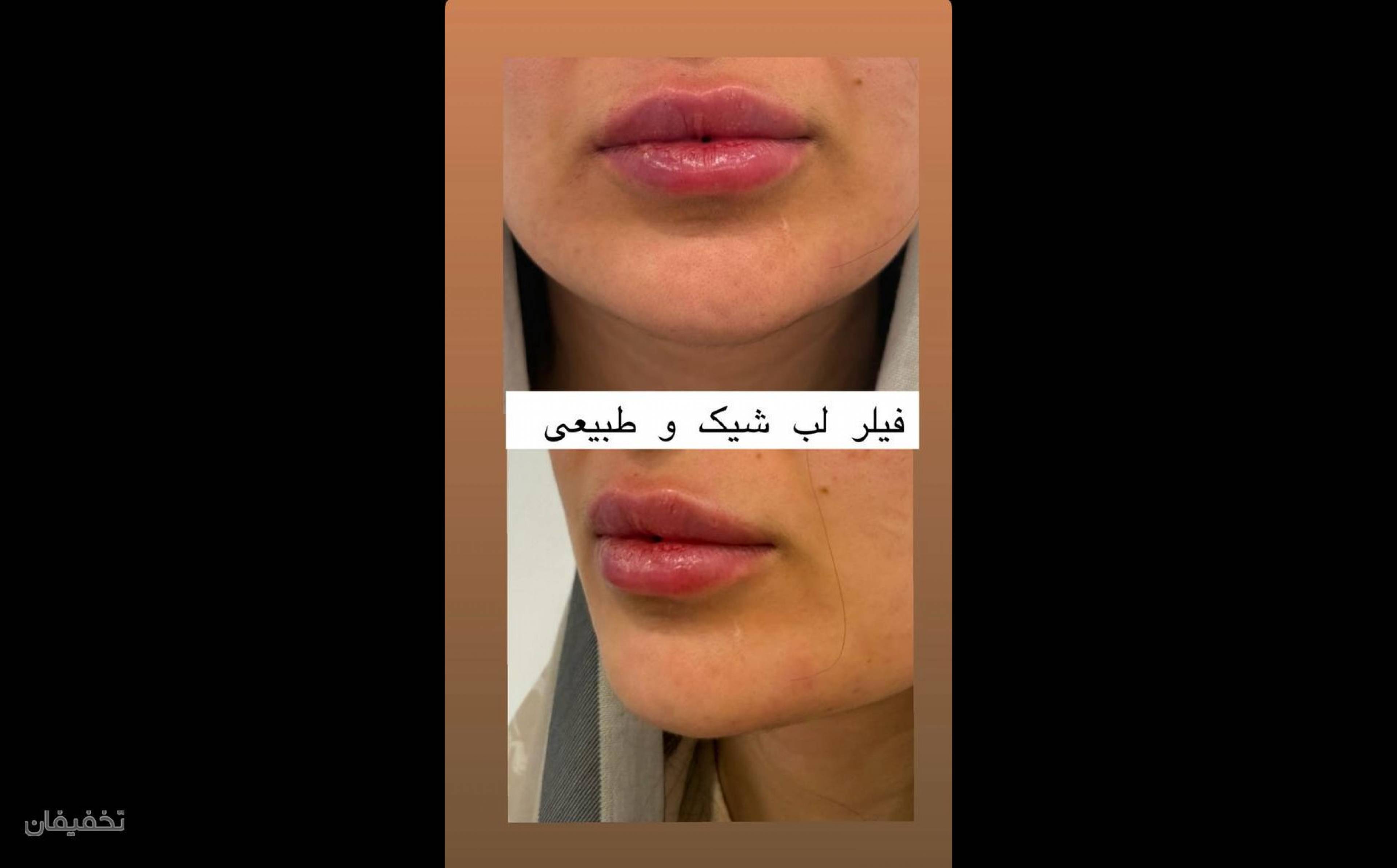 کلینیک زیبایی زارا