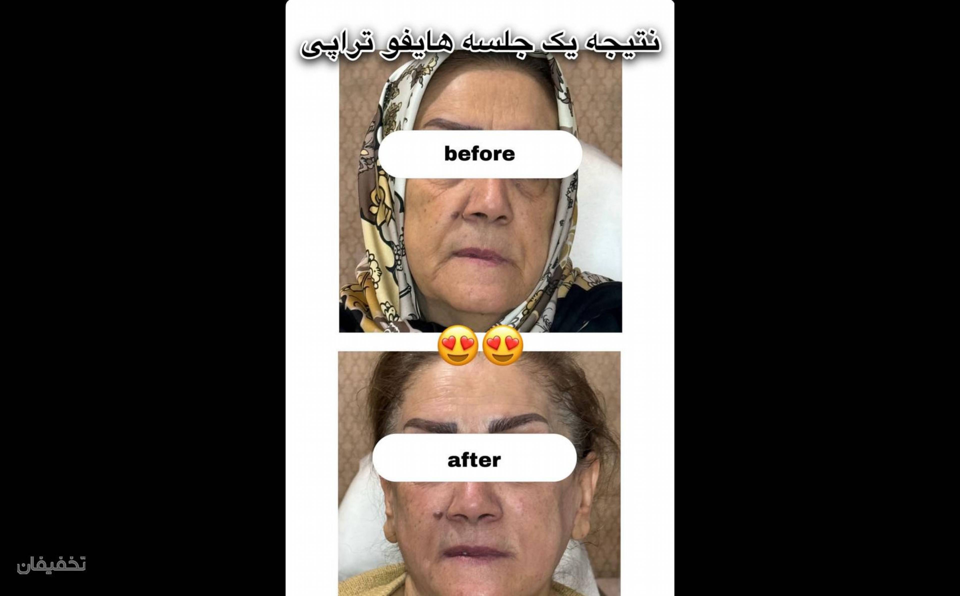 کلینیک زیبایی زارا