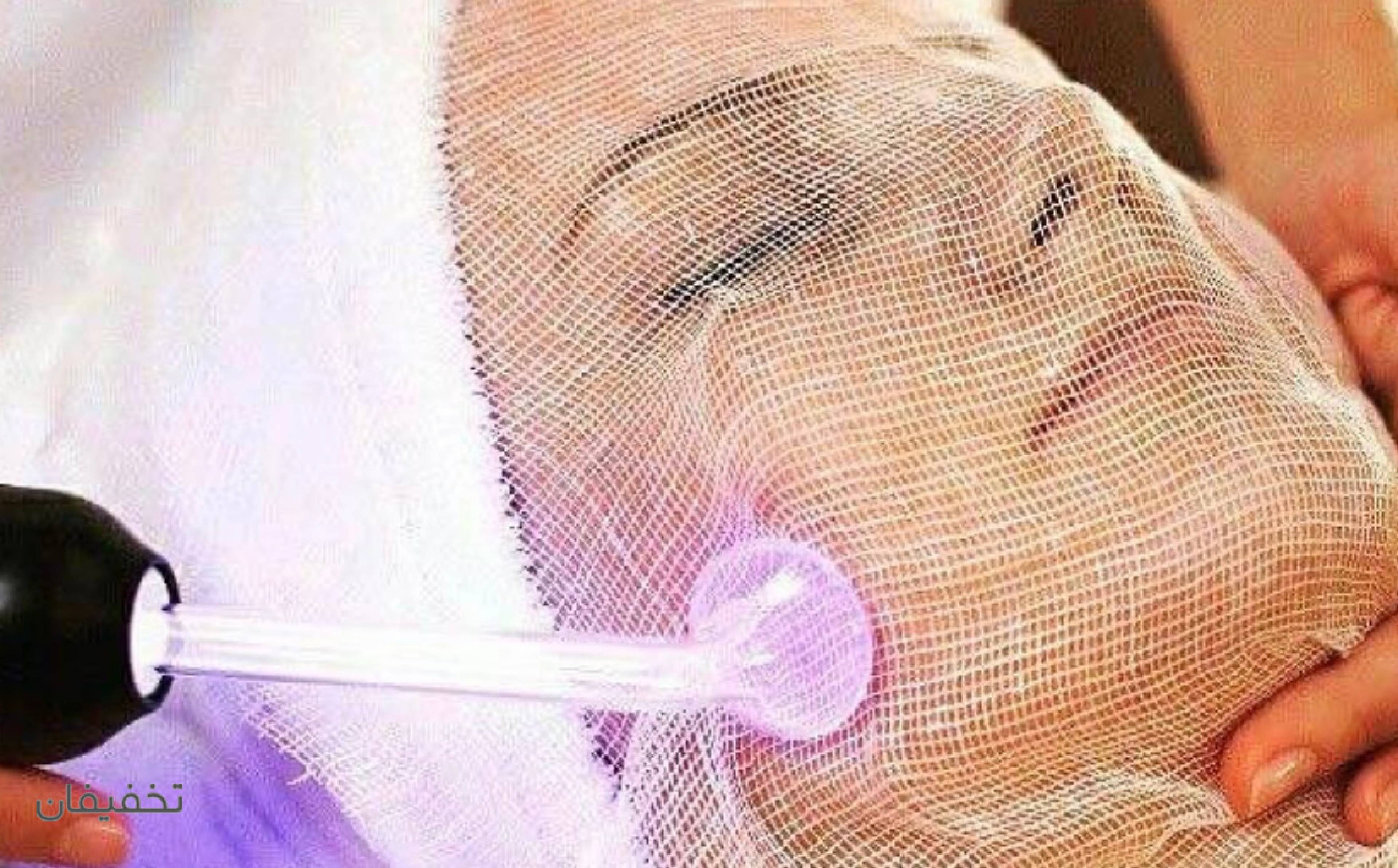 پاکسازی و فیشیال آویش 