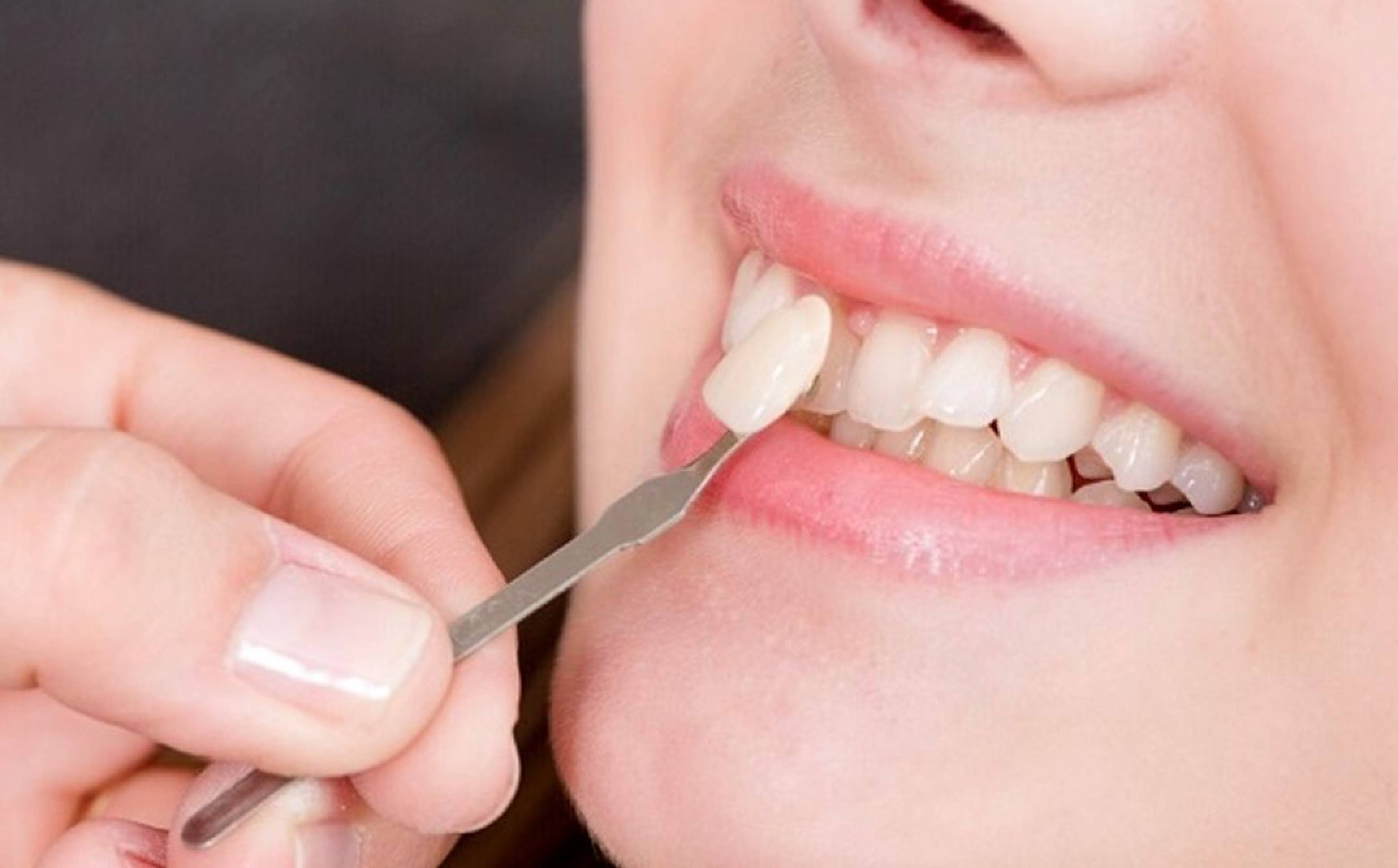 مطب دندانپزشکی دکتر زهرا محسنی 